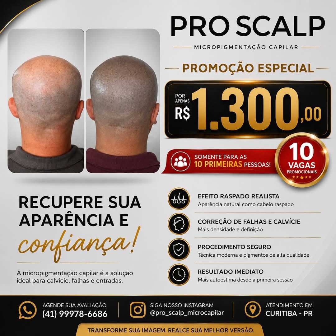 Marcio Leite Albuquerque Facebook ad: Promoção Micro pigmentação capilar