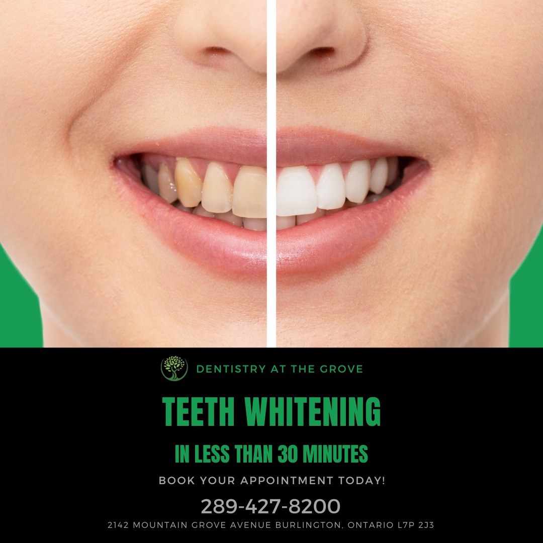 Dentistry at The Grove Facebook ad: Get a dazzling smile in just 30 minutes!