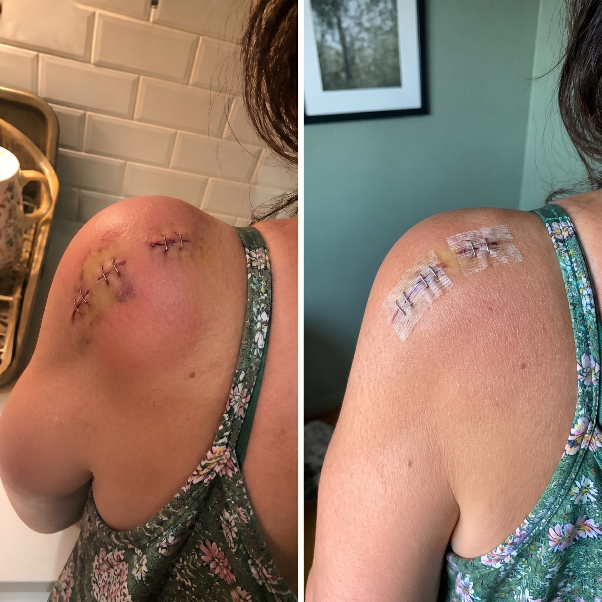 Rachel Harmon Facebook ad: Read this if surgery didn't fix your shoulder