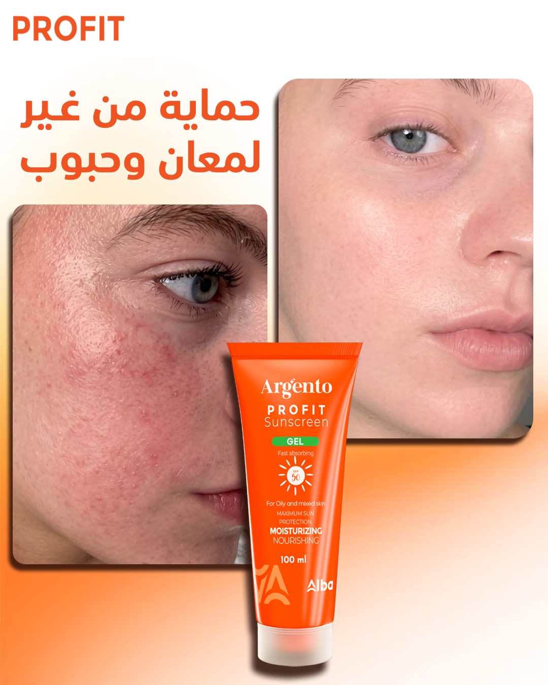 Profit SunBlock Facebook ad: الصن بلوك بيسبب لمعان وملمس دهني؟