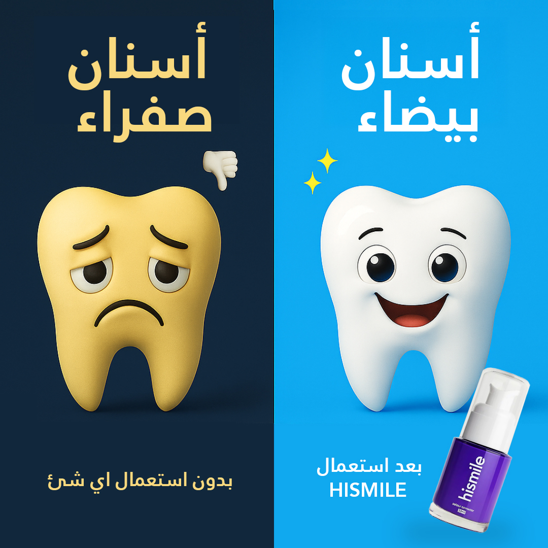 Hismile Facebook ad