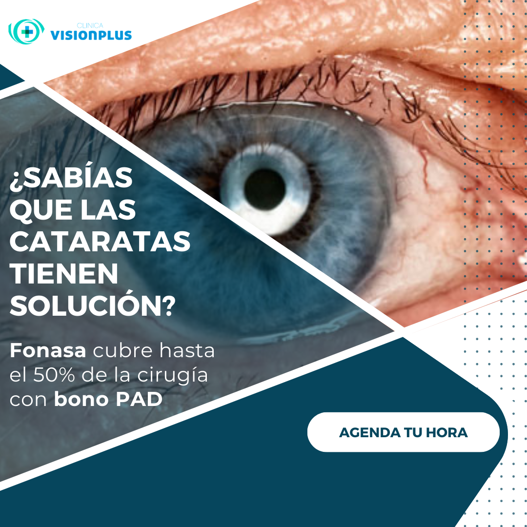 Visión Plus Facebook ad