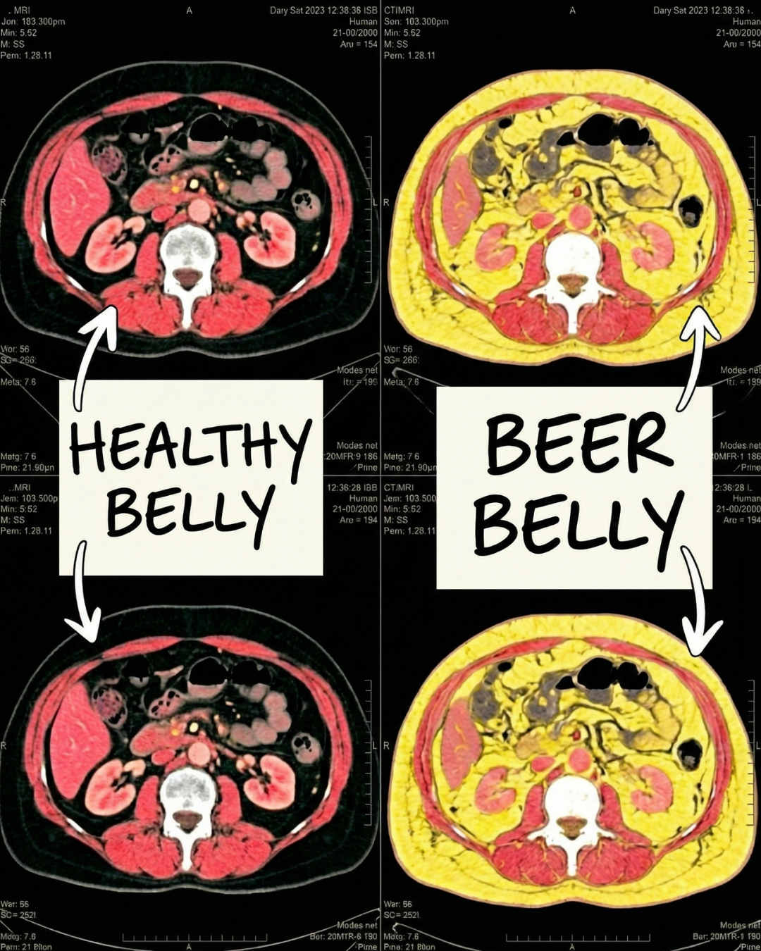 Mark Wilson Facebook ad: Struggling with a Beer belly? Read this