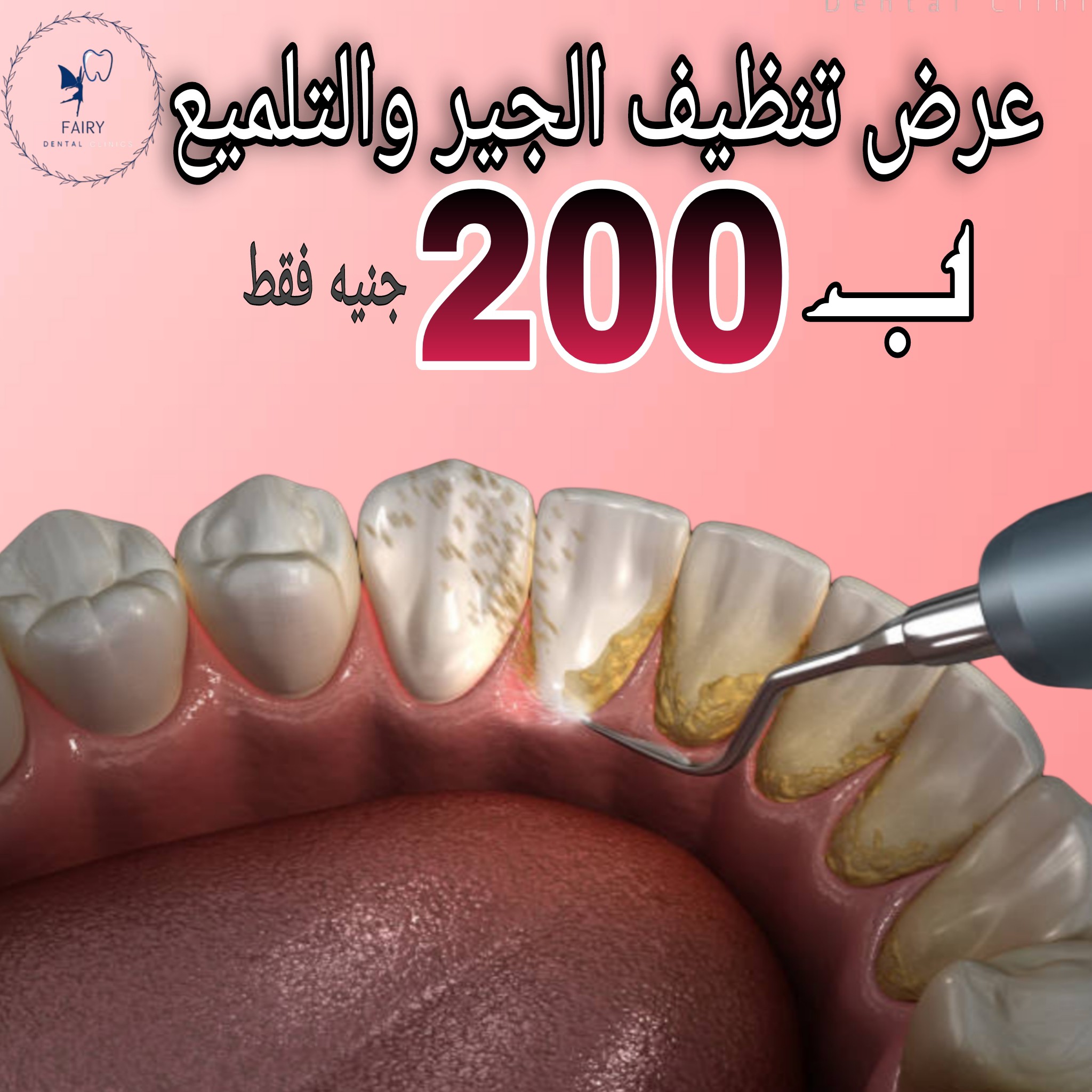 Fairy Dental clinics Facebook ad: خصم أكتر من 50% على جميع خدمات الأسنان