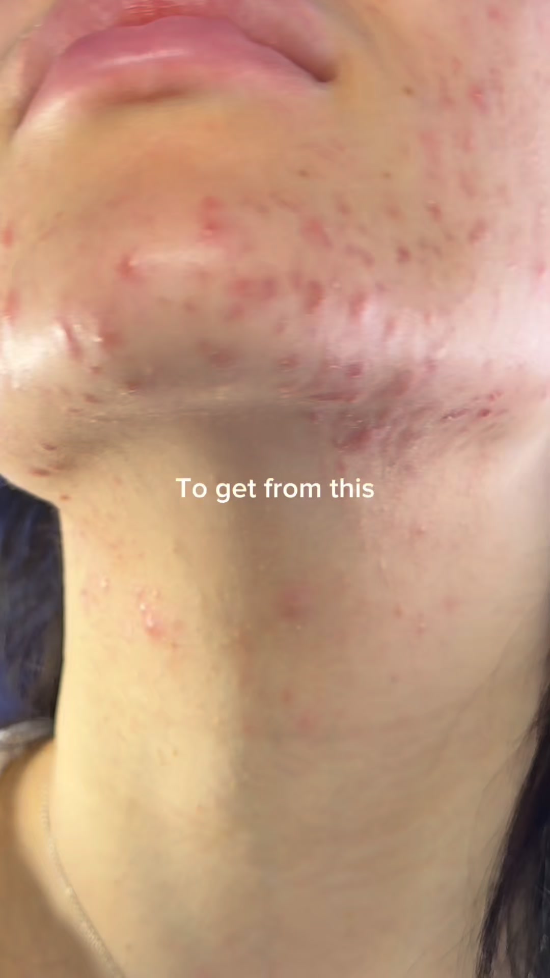 SupleLife Facebook ad: Dr Althea 345 Viral