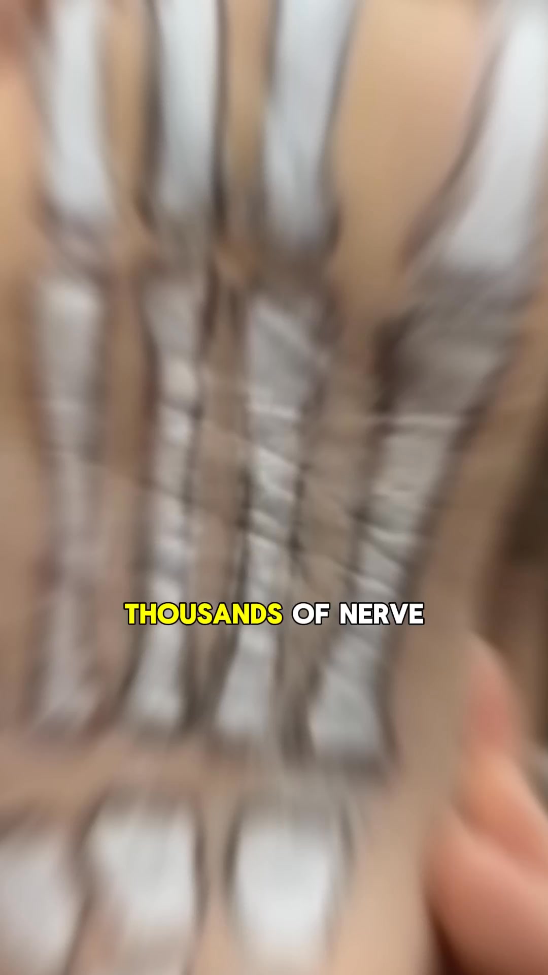 Senzio Facebook ad: There's Hope for Nerve Damage