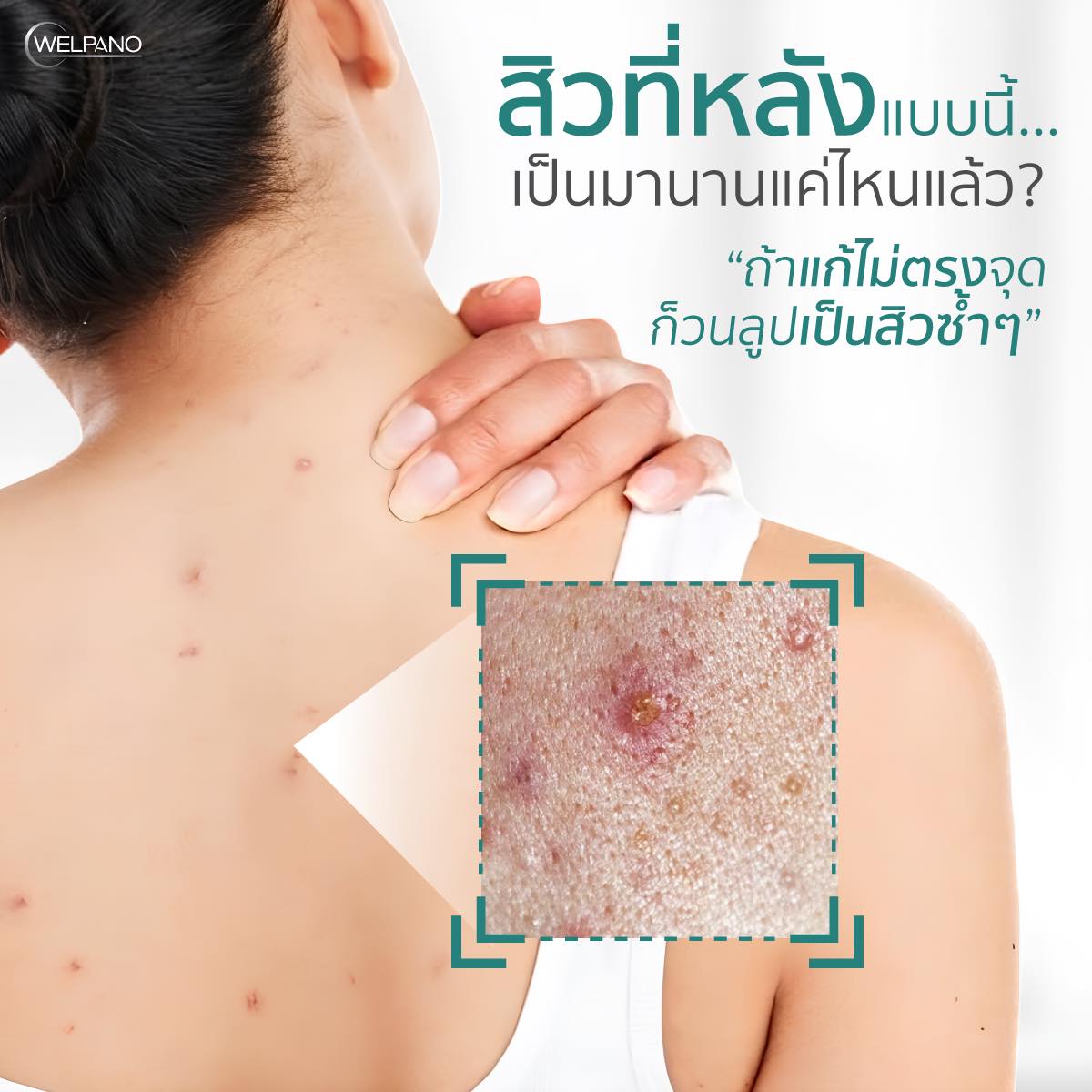 Welpano Cosmetics : เวชสำอางโดยเภสัชกร Facebook ad