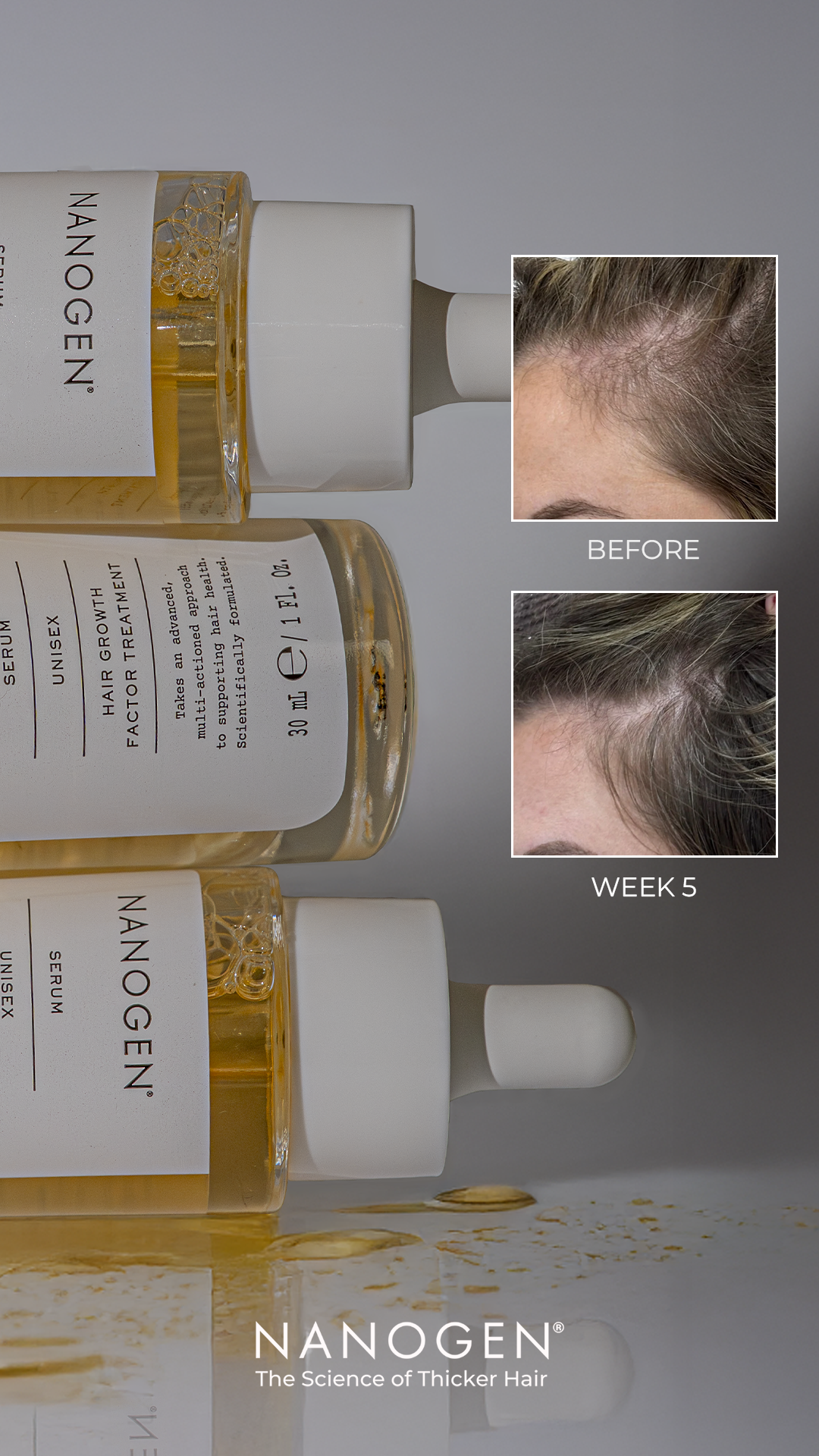 Nanogen - The Science of Thicker Hair Facebook ad