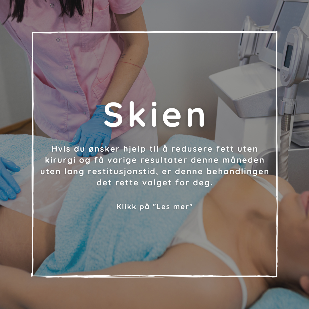 Beautylines Facebook ad: Akkurat nå for kun 990 kr (Ord. pris 2500 kr)