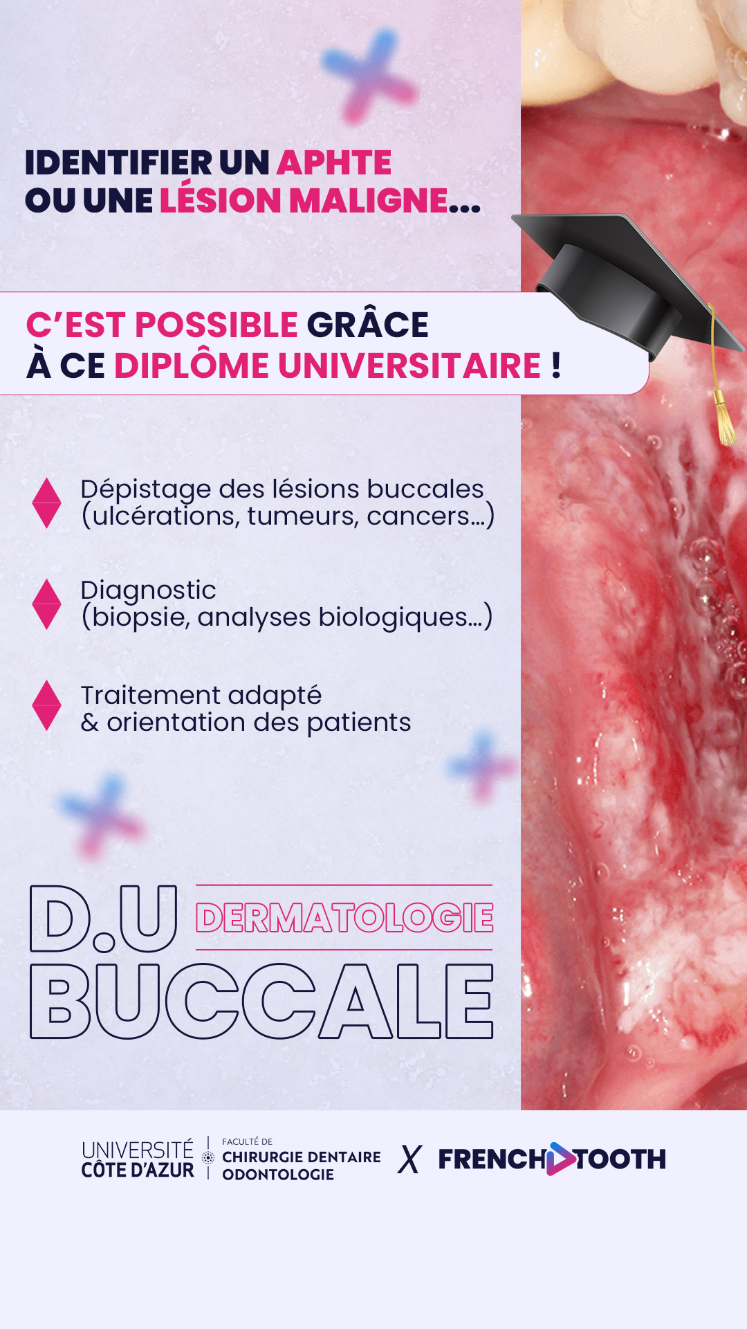 French Tooth Facebook ad