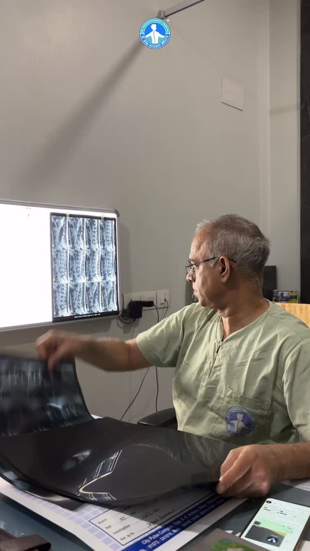 Dr. Yogesh Kayakalp Hospital Facebook ad: हर Back Pain में Surgery जरूरी नहीं होती…