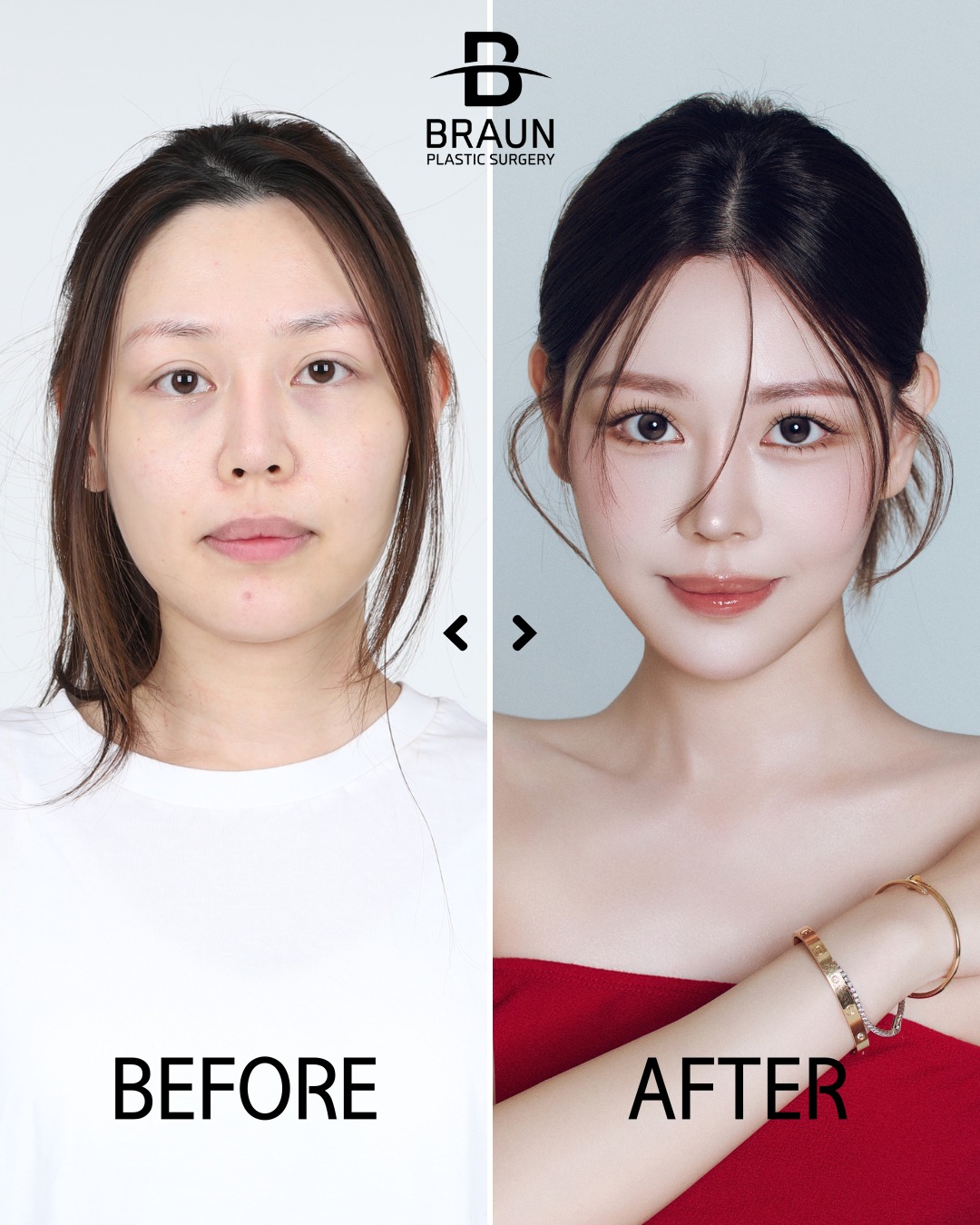Braun plastic surgery korea Facebook ad: BRAUN Plastic surgery