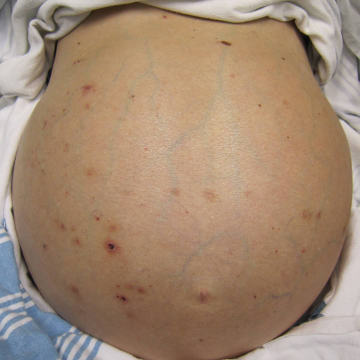 Dr. Angelina Young Facebook ad
