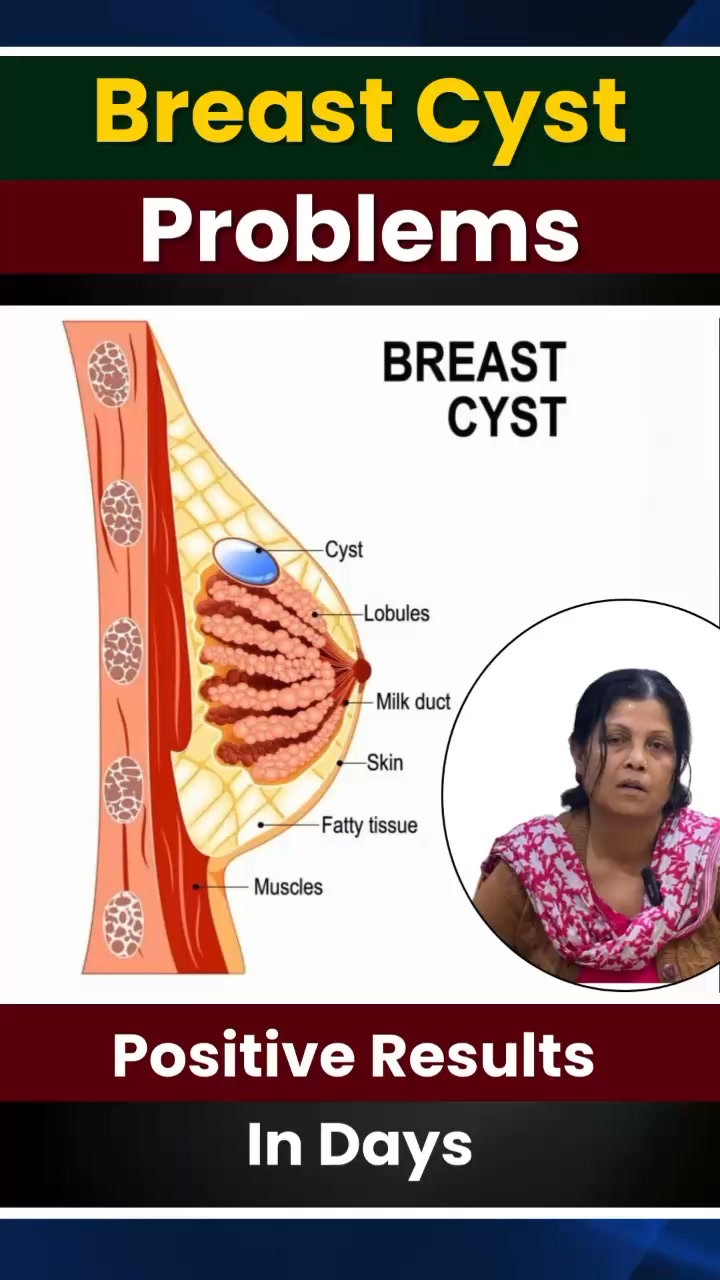 Chandigarh Ayurved Centre Facebook ad: How Ayurveda Helped Heal Breast Cysts and Lumps…