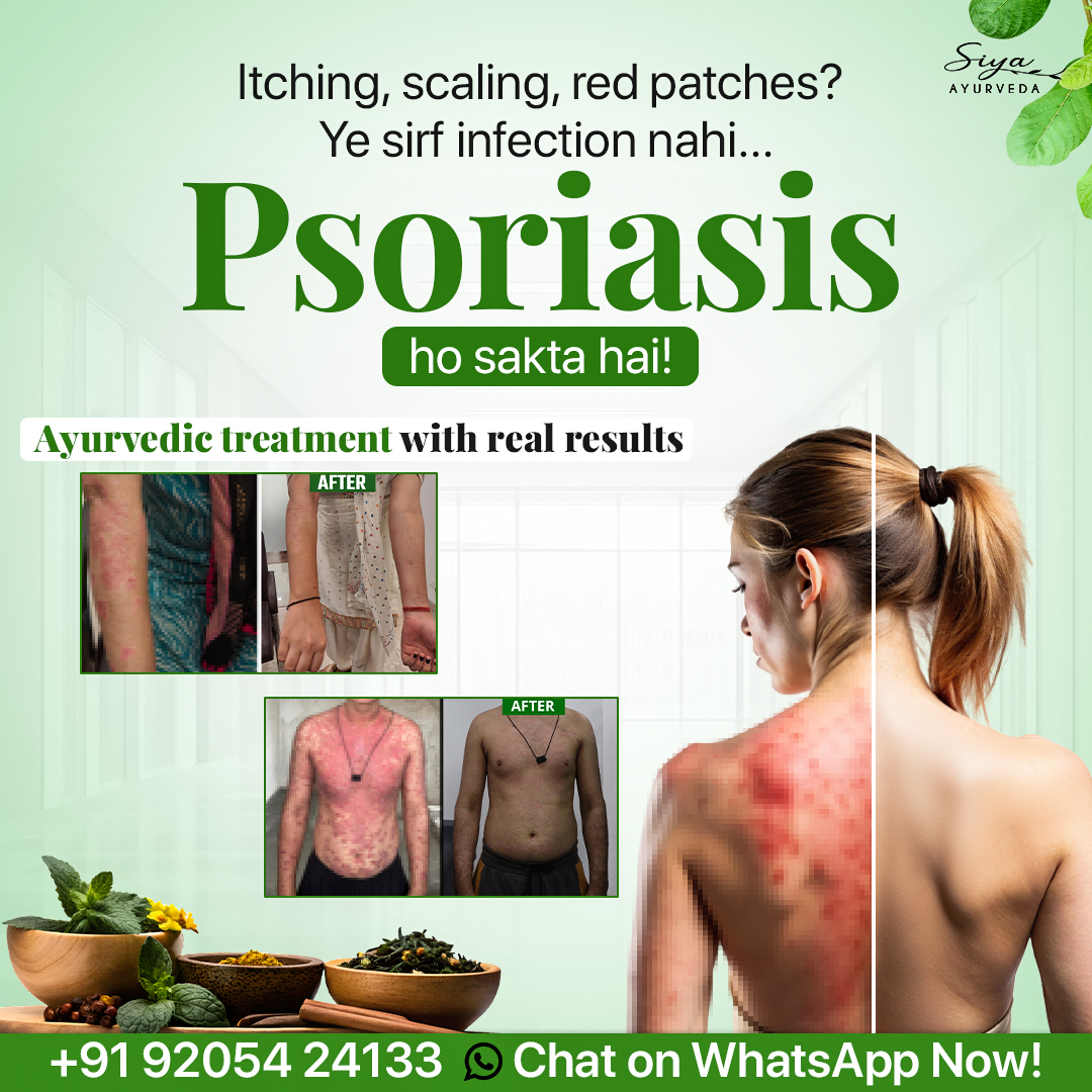 Siya Ayurveda Facebook ad from Jan 9, 2026