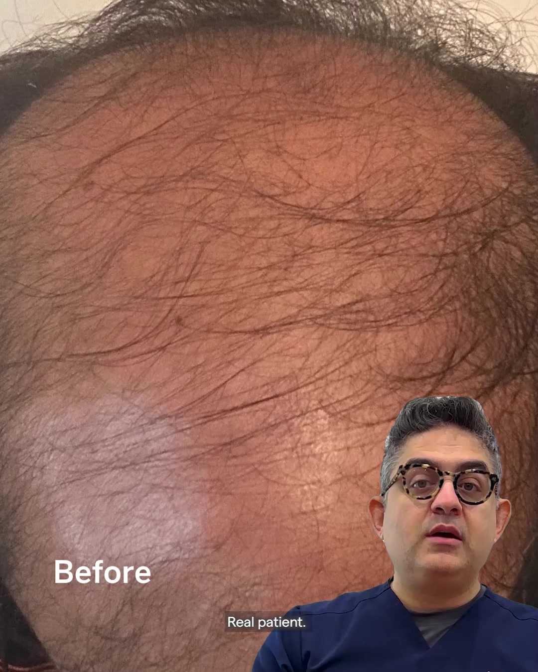 Happy Head Facebook ad: See results in 3 to 6 months