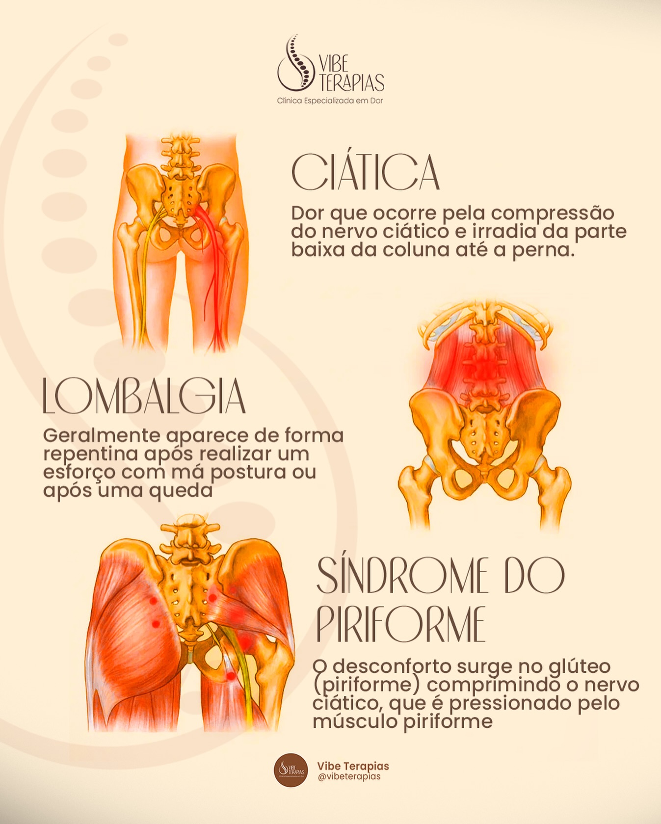 Vibe Terapias Facebook ad