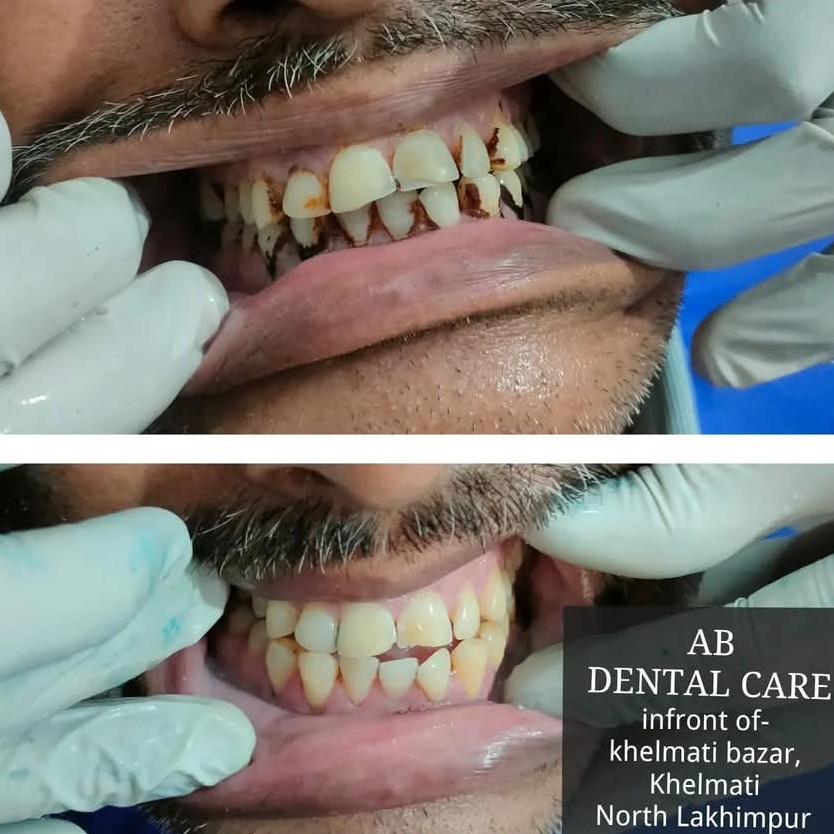 AB Dental Care Facebook ad: NH-15