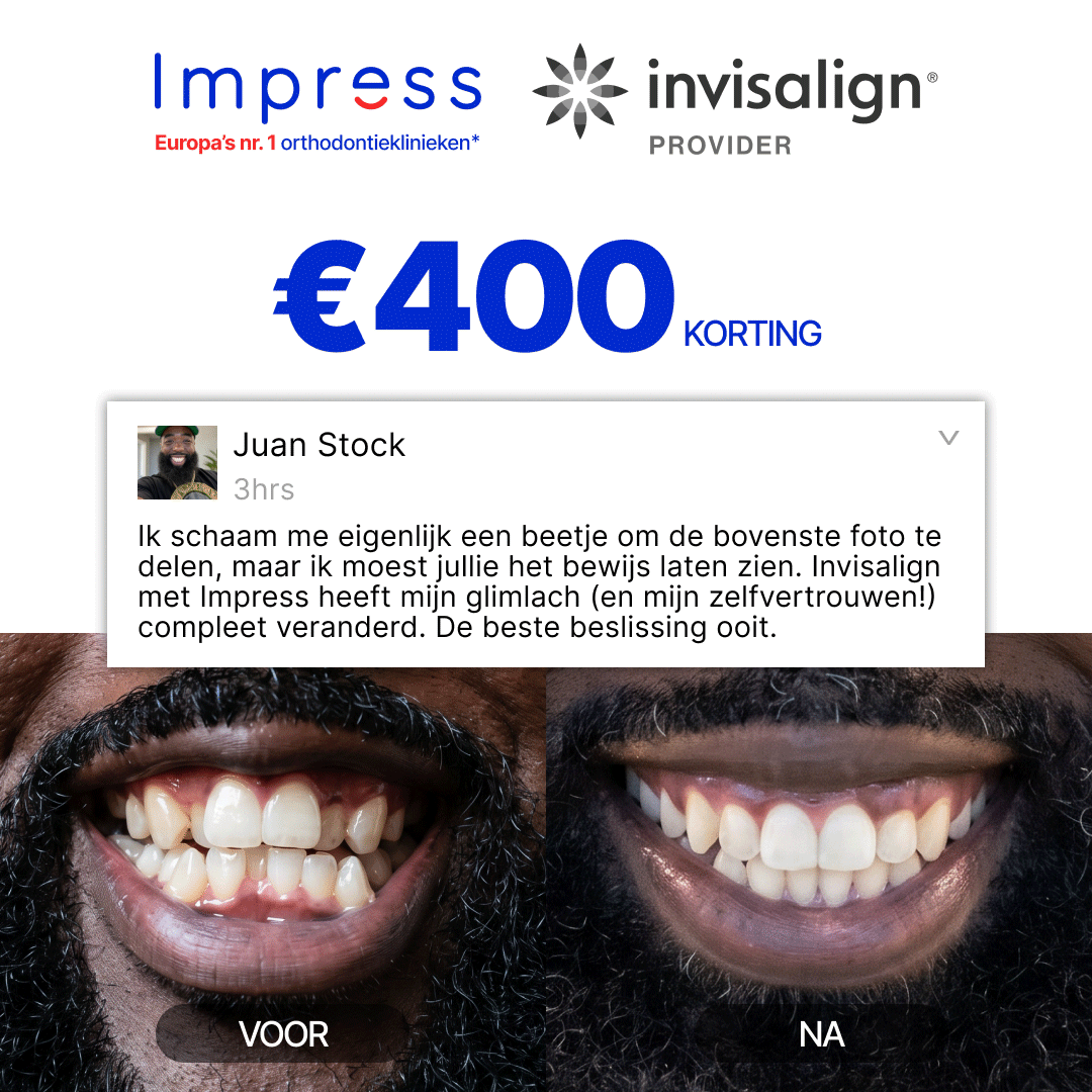 Impress Nederland Aligners Facebook ad