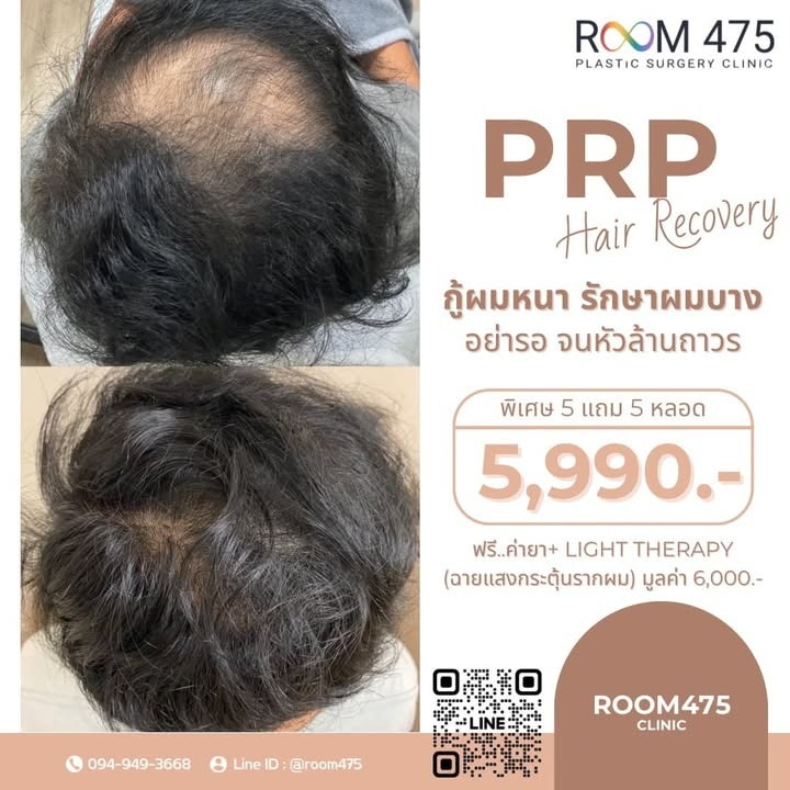 Room475 คลินิกเฉพาะทางศัลยกรรมตกแต่ง Facebook ad: ด่วน! จำกัด 30 สิทธิ์