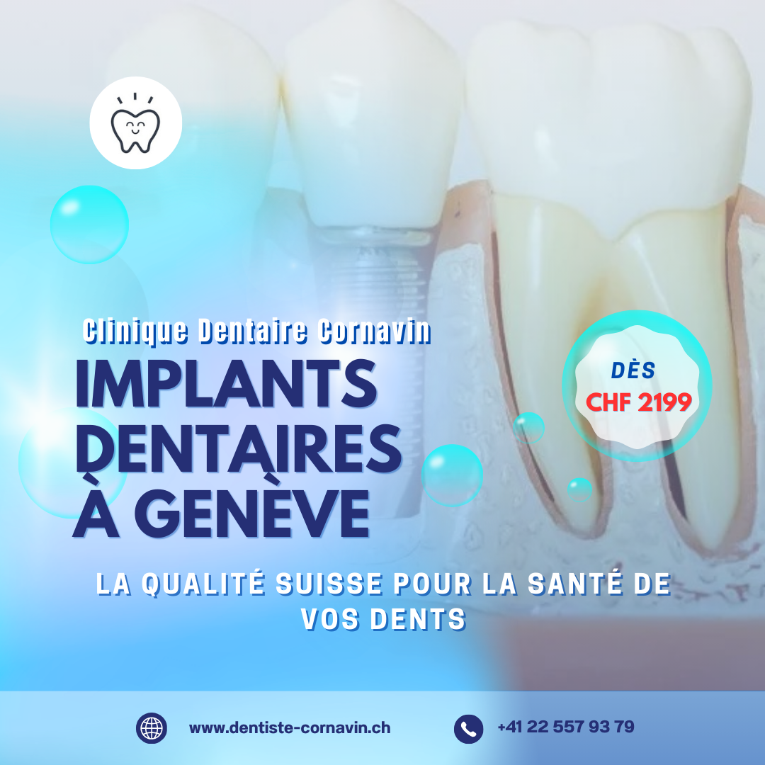 Clinique Dentaire Cornavin à Genève Facebook ad