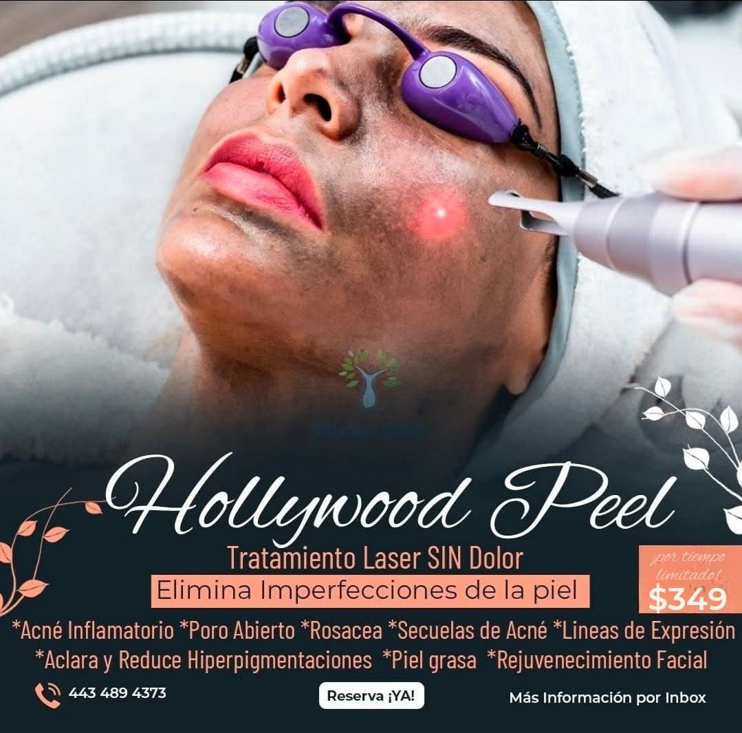 Clínica Belle Facebook ad: Hollywood Peel $349