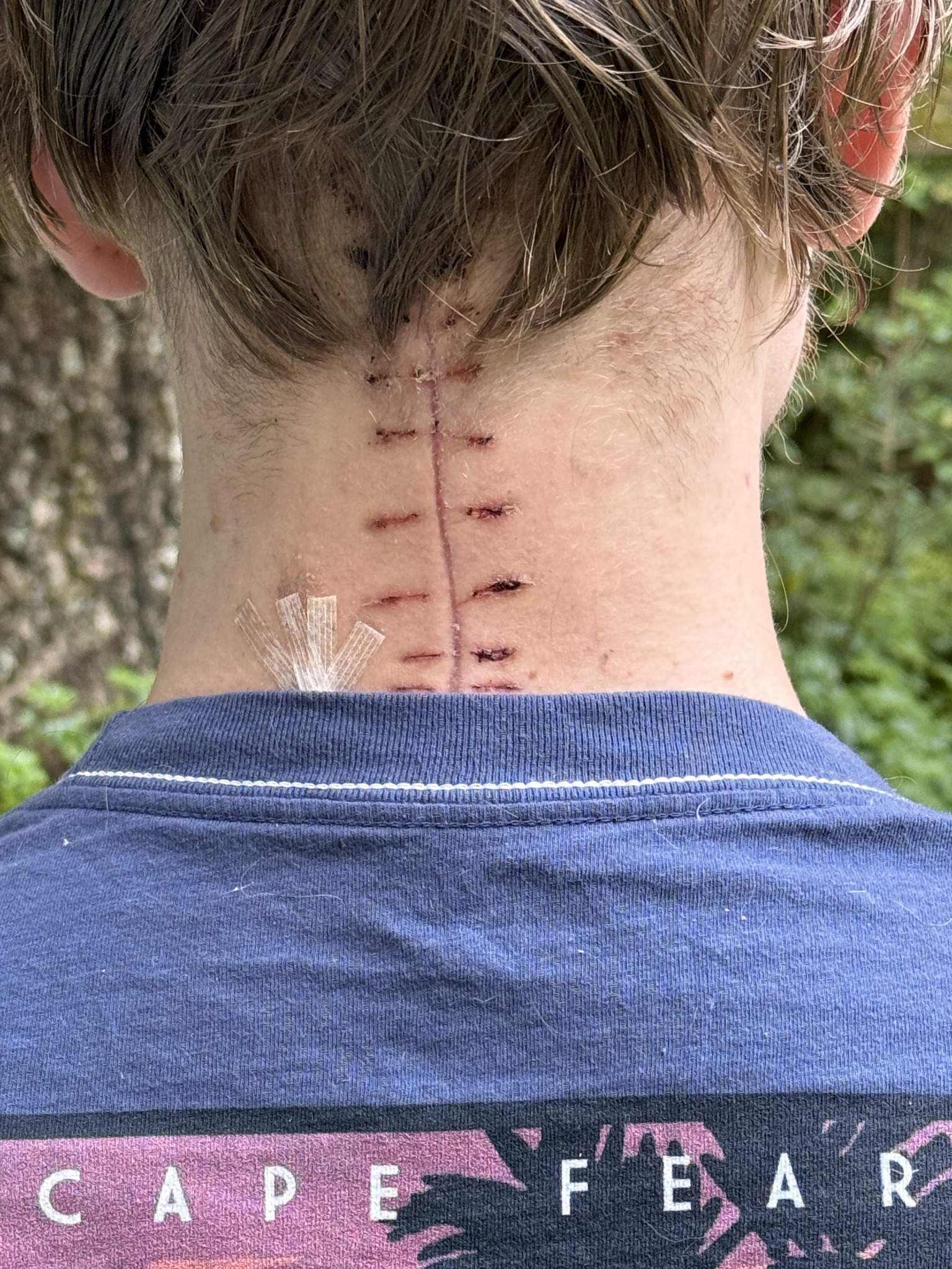 Healthy Neck Magazine Facebook ad