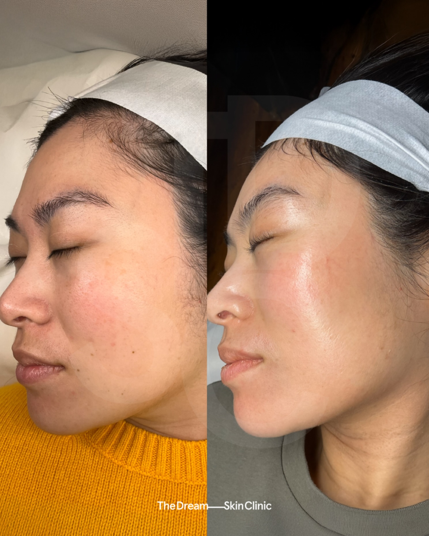 The Dream Skin Clinic Facebook ad: Reputation for Results