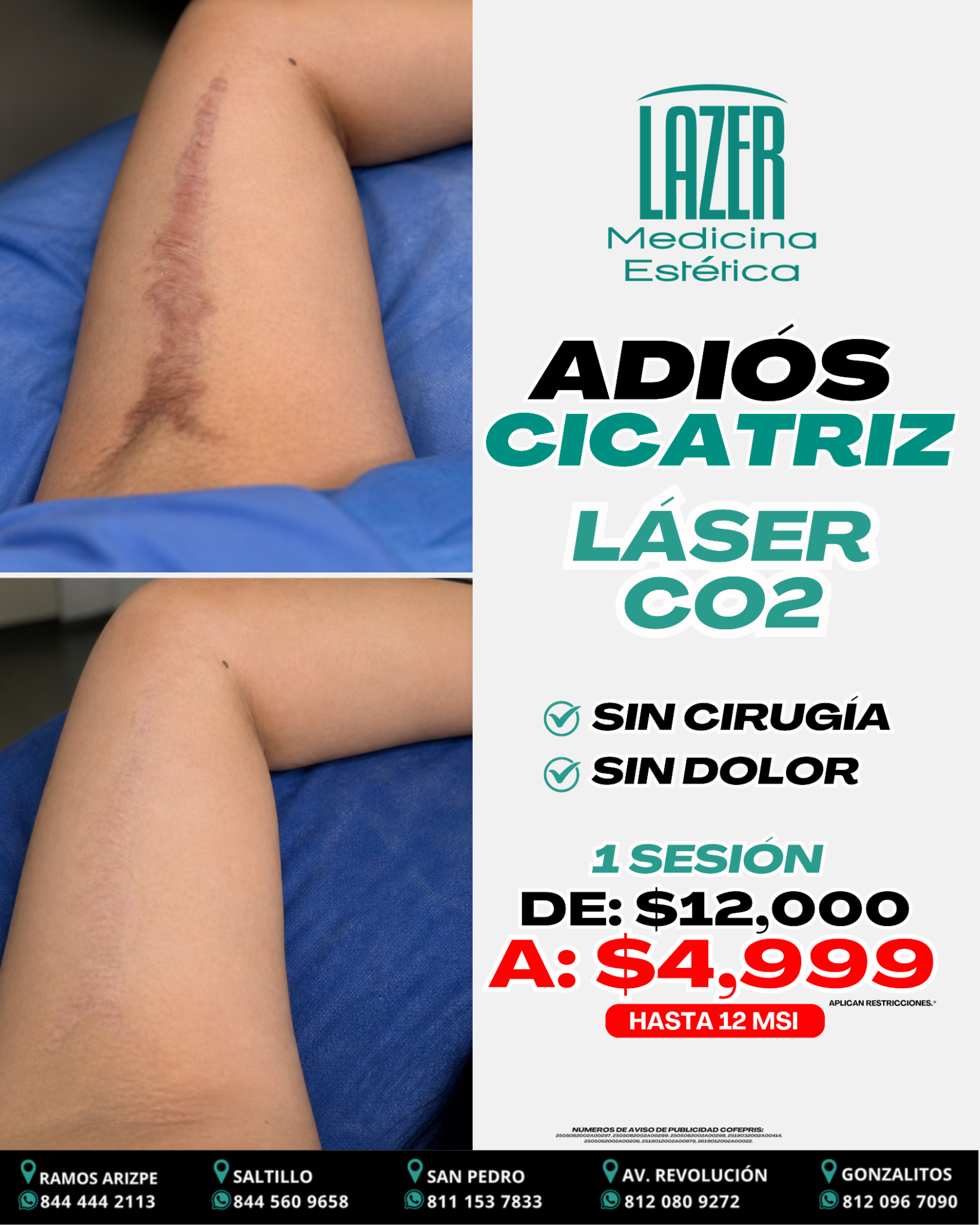 Lazer Medicina Estética MX Facebook ad