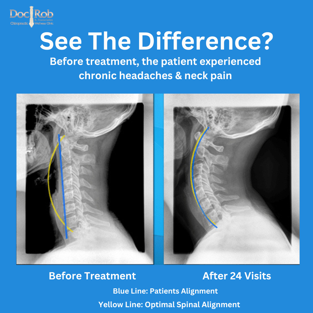 Doc Rob's Chiropractic in Quezon City Facebook ad