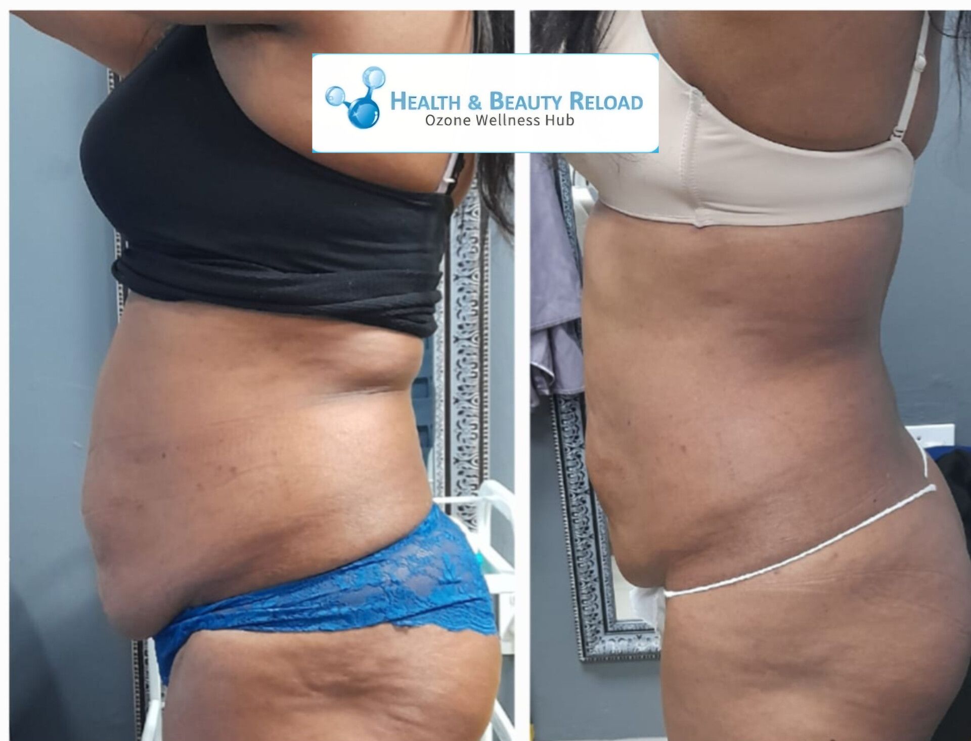 Belle HealthReload Facebook ad: Fat-Freeze Results