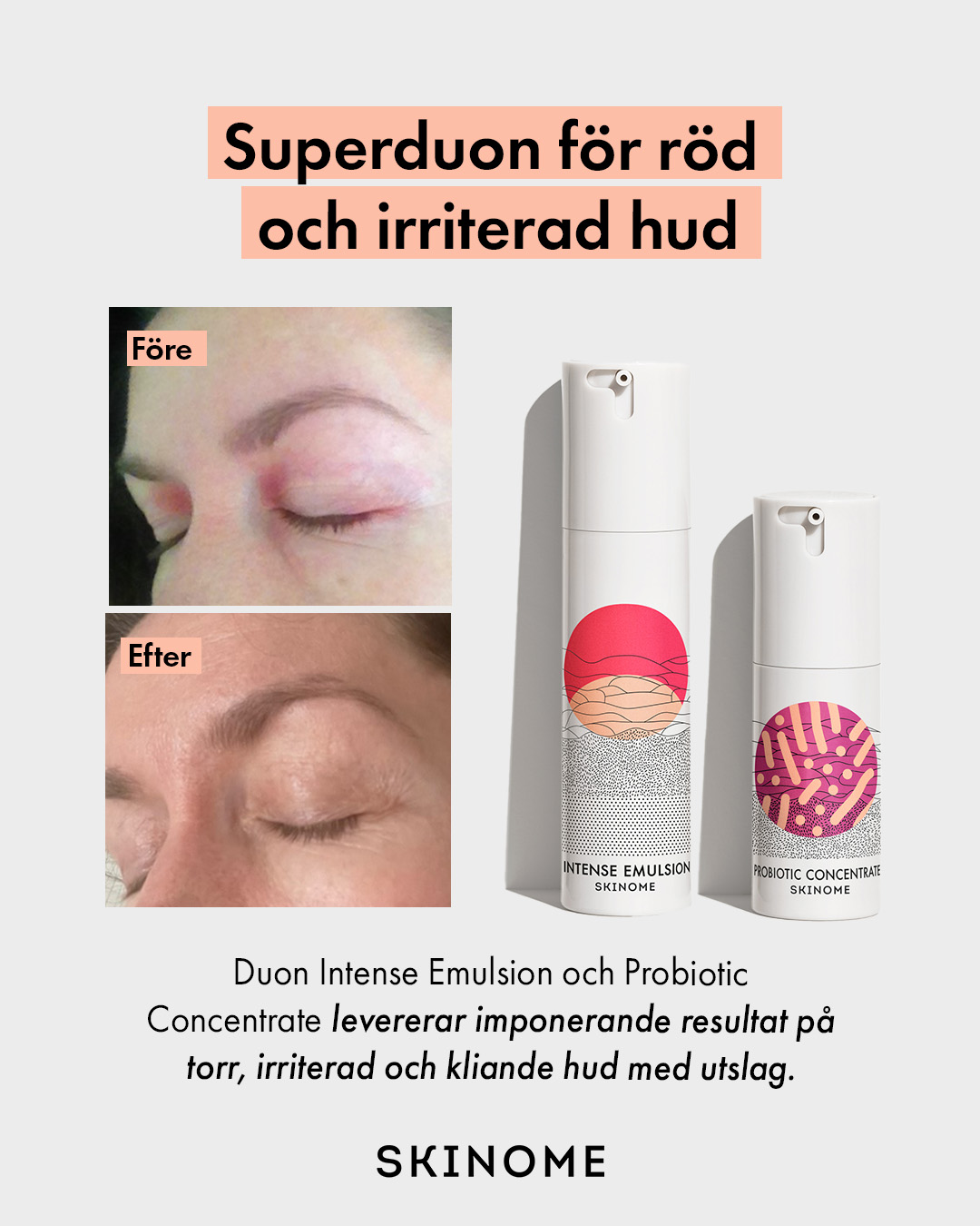 Skinome Facebook ad