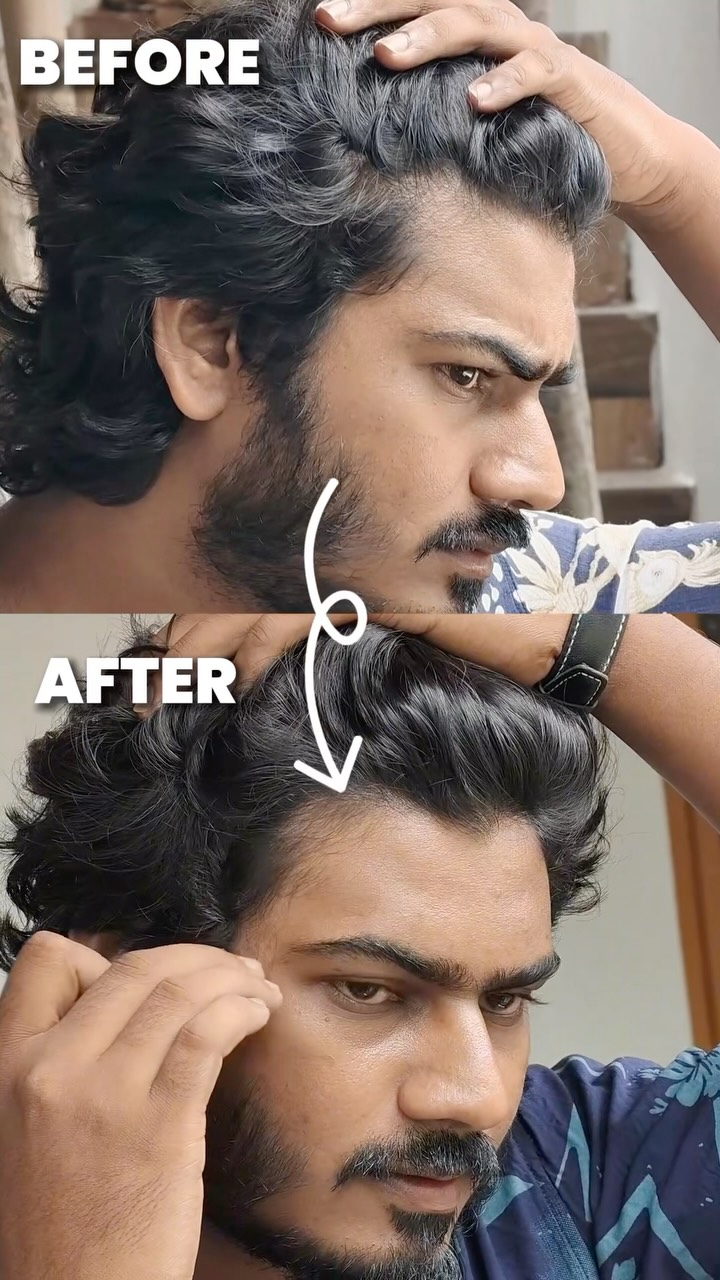 Bare Anatomy Facebook ad: One serum closer to better hair day