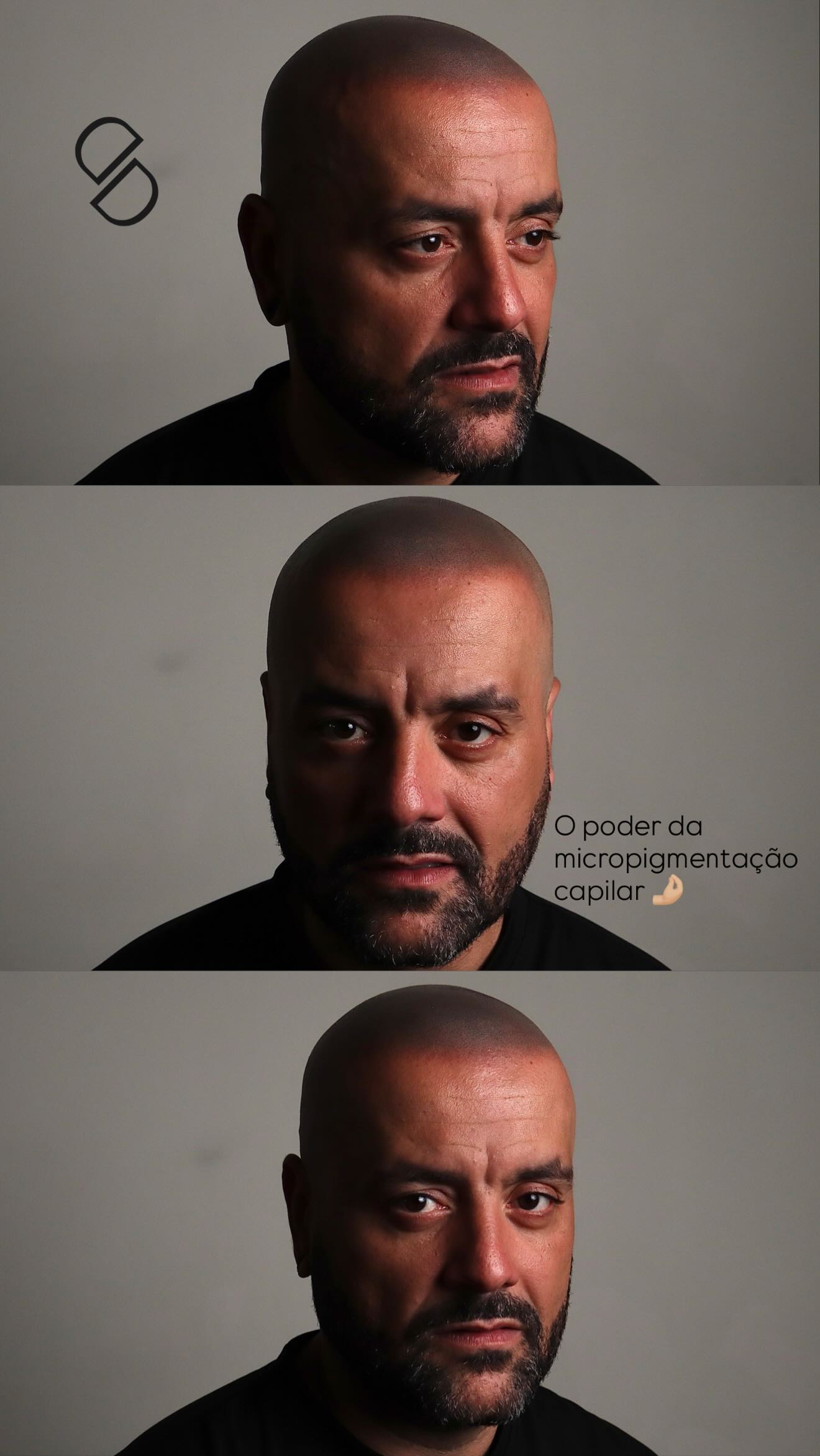 Simone Dias Micropigmentação e Estética Facebook ad: O poder da