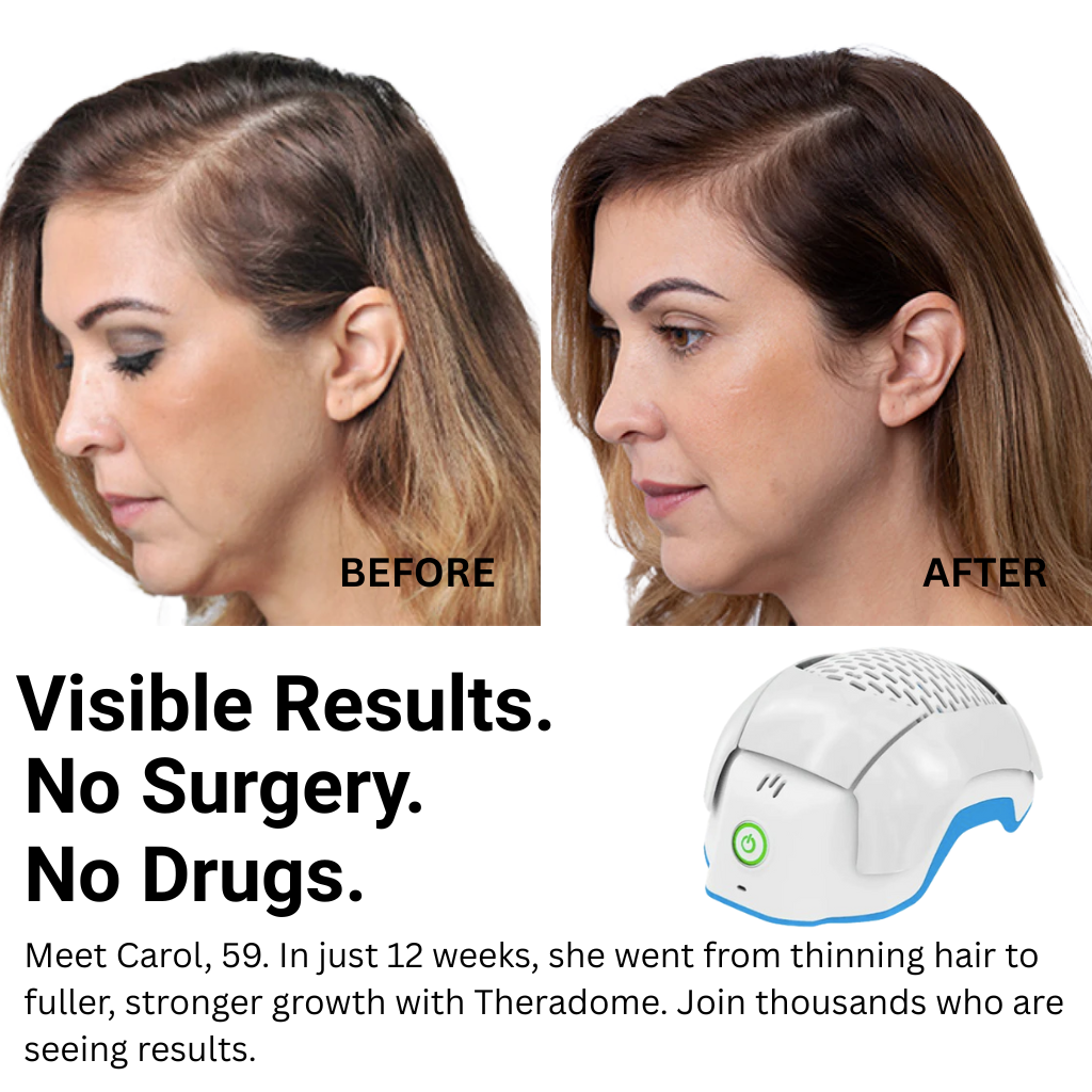 Theradome Facebook ad