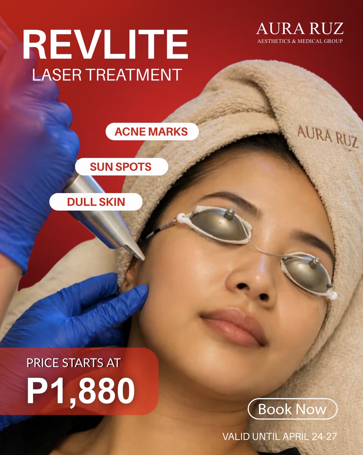 The Aura Ruz Timog Branch Facebook ad: REVLITE LASER PROMO