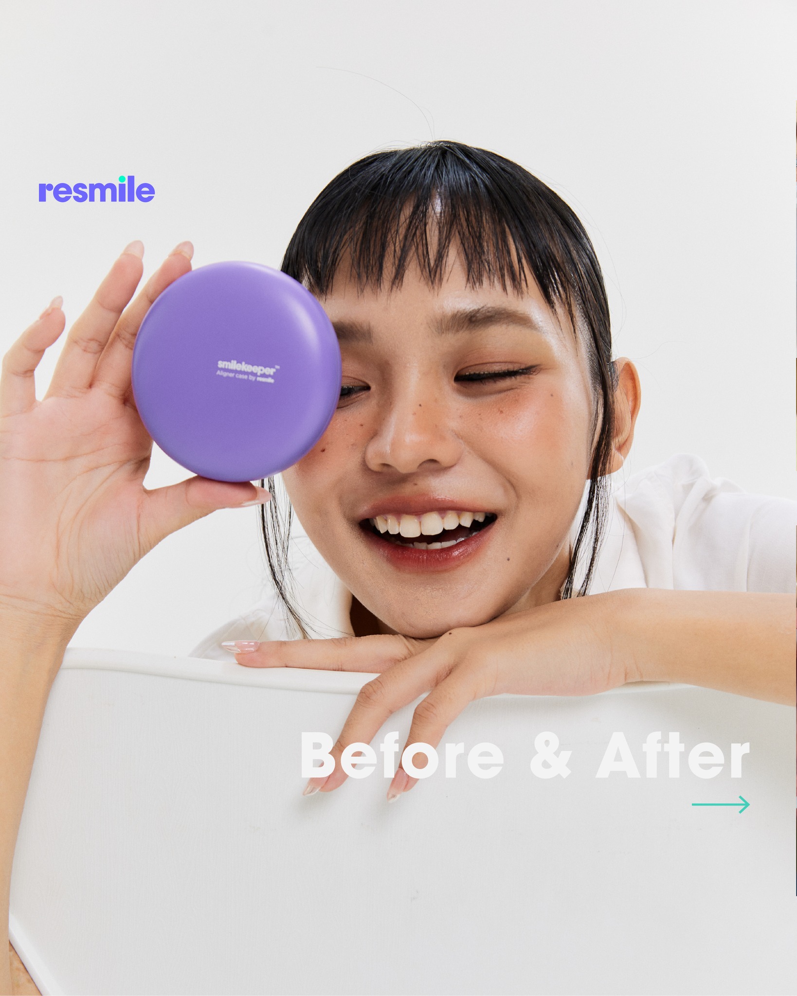Resmile คลินิกจัดฟันใสเฉพาะทาง Facebook ad