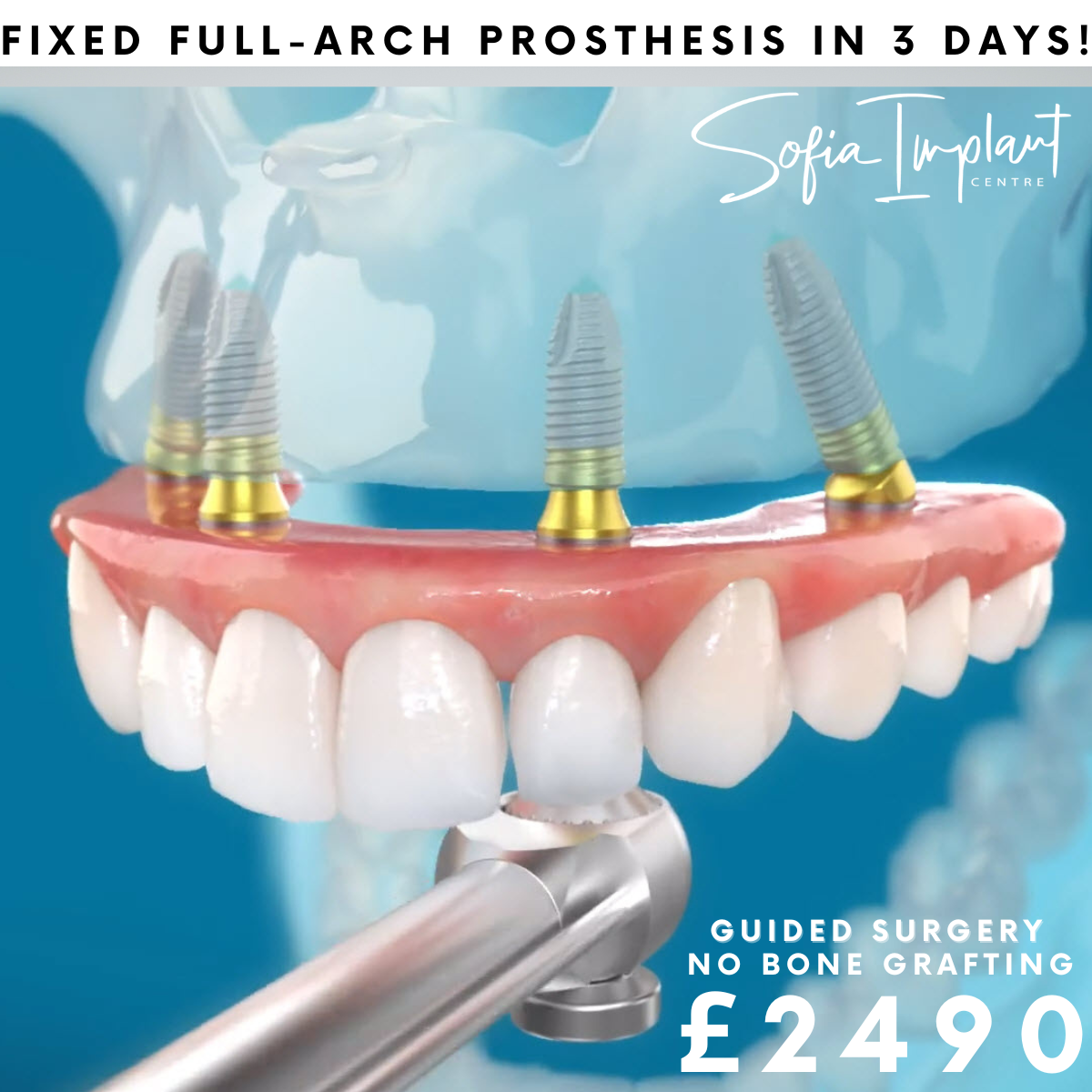 Sofia Implant Centre Facebook ad