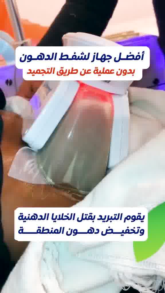 اتقان لعلاج السمنة Facebook ad: أكتشفى جمالك بأفضل العروض والخصومات
