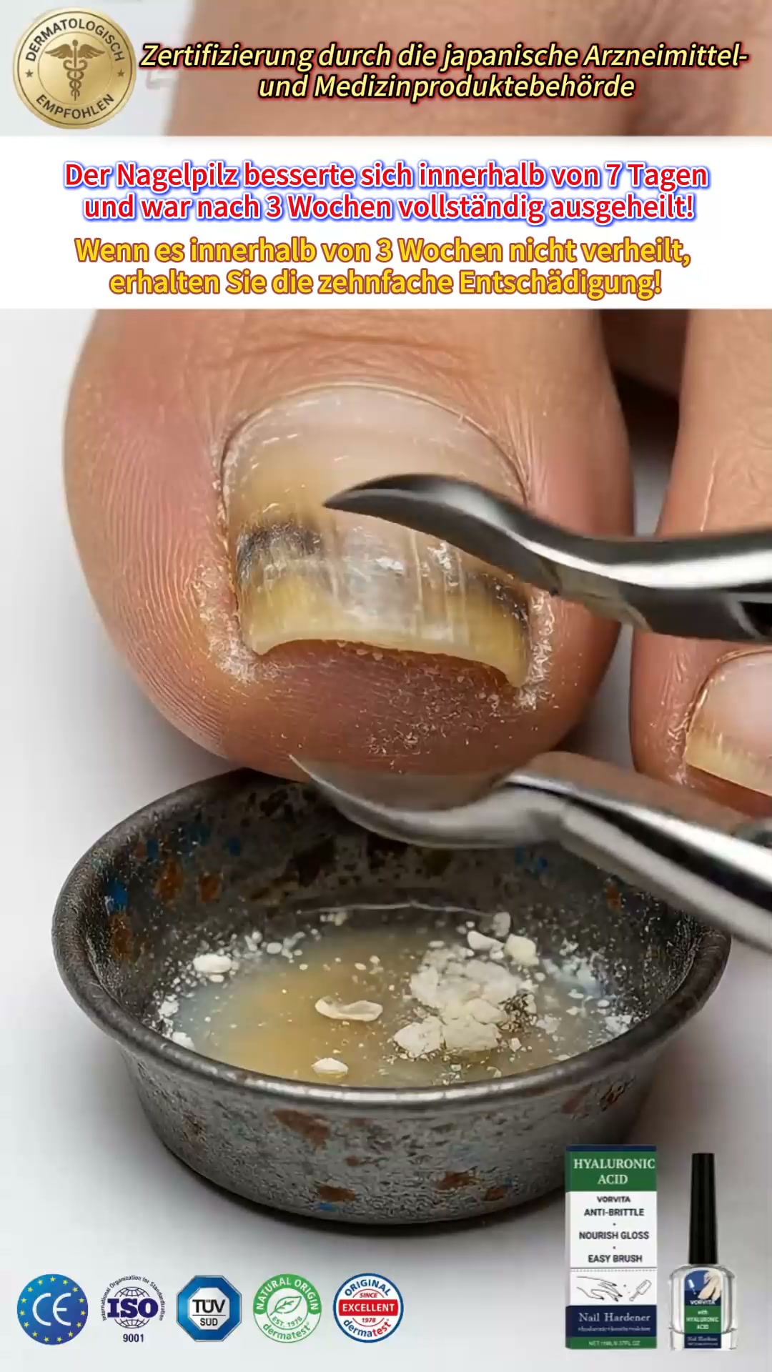 Bizzflowhub3 Facebook ad: Gelbe, dicke oder brüchige Nägel?