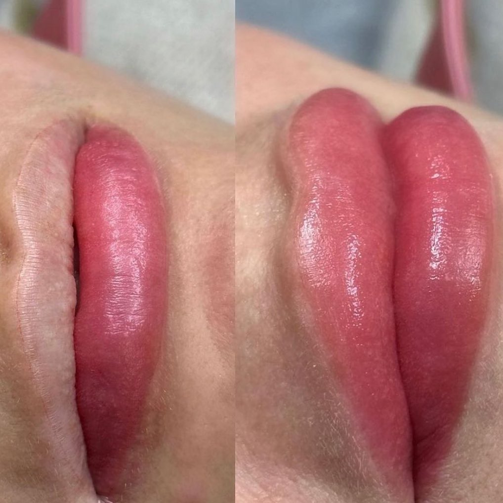 Estudio Antonella Paludi Facebook ad: LABIOS que ENAMORAN