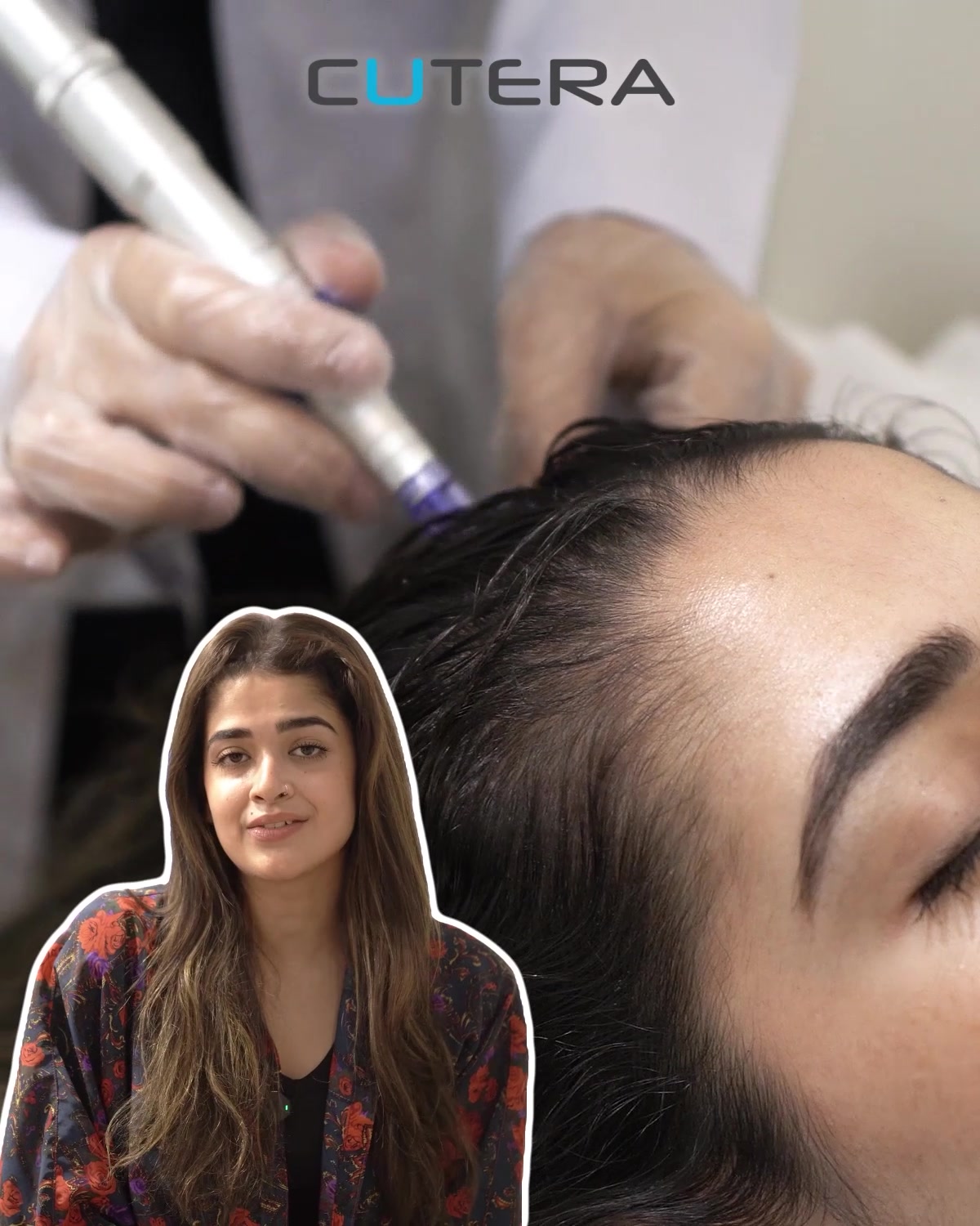 Cutera Hair Clinic Facebook ad: End Hair Loss with Cutera