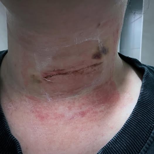 Healthy Neck Magazine Facebook ad