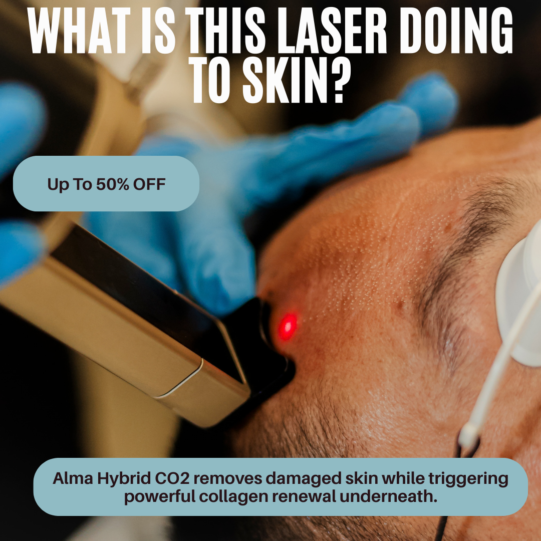Pulse Laser Aesthetic Clinic - London Facebook ad: Up to 50% OFF CO2 Laser Skin Resurfacing