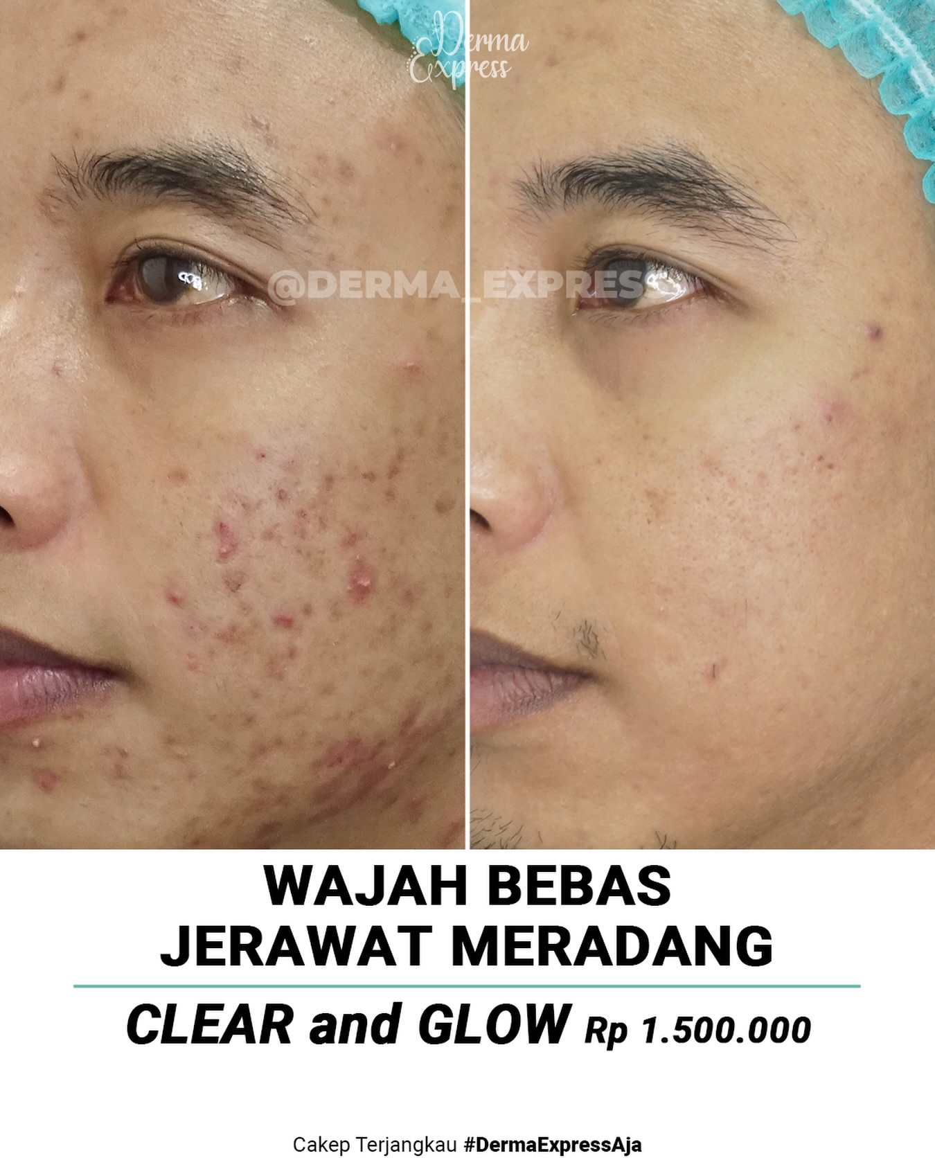 derma_express Facebook ad