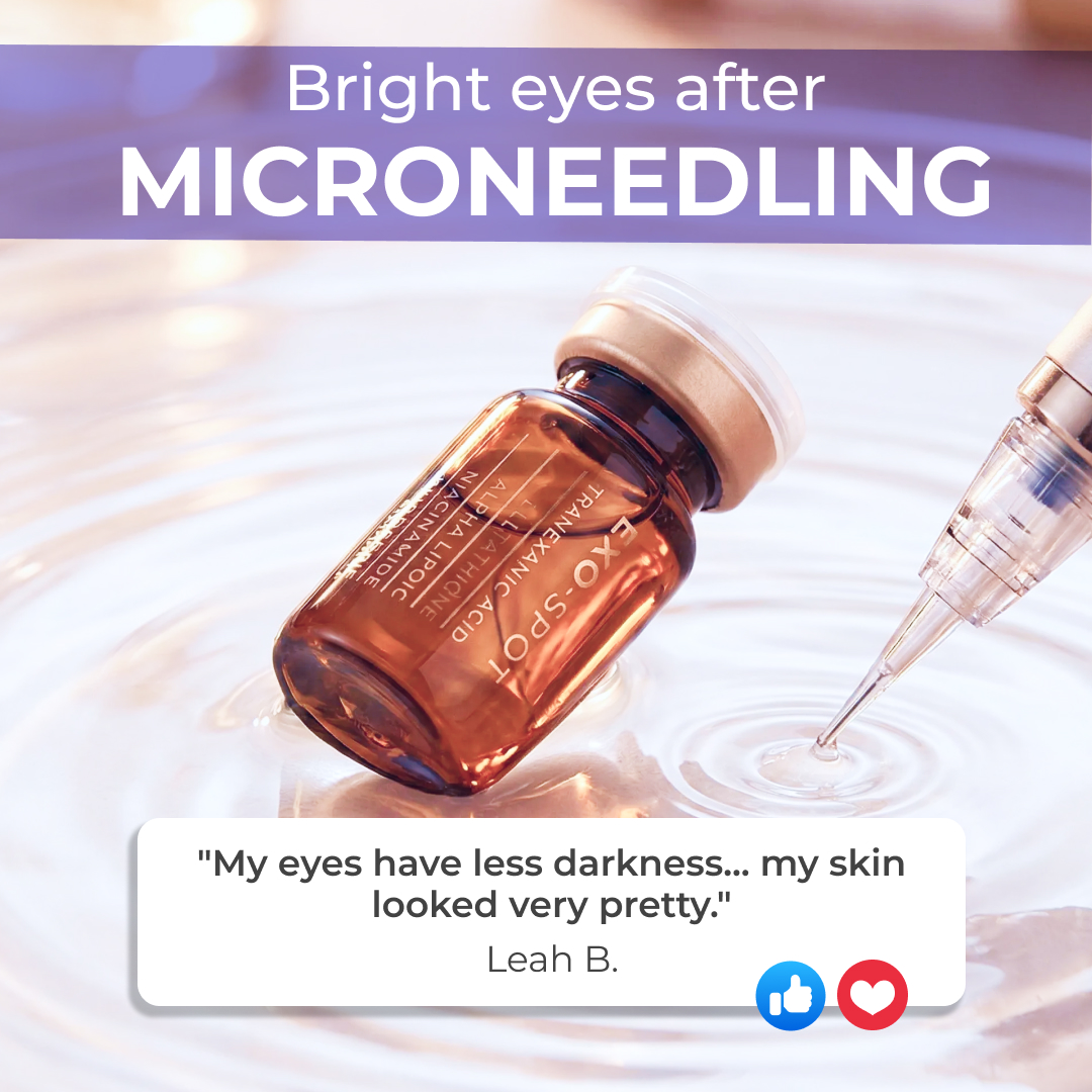 Platinum Skin Care Facebook ad