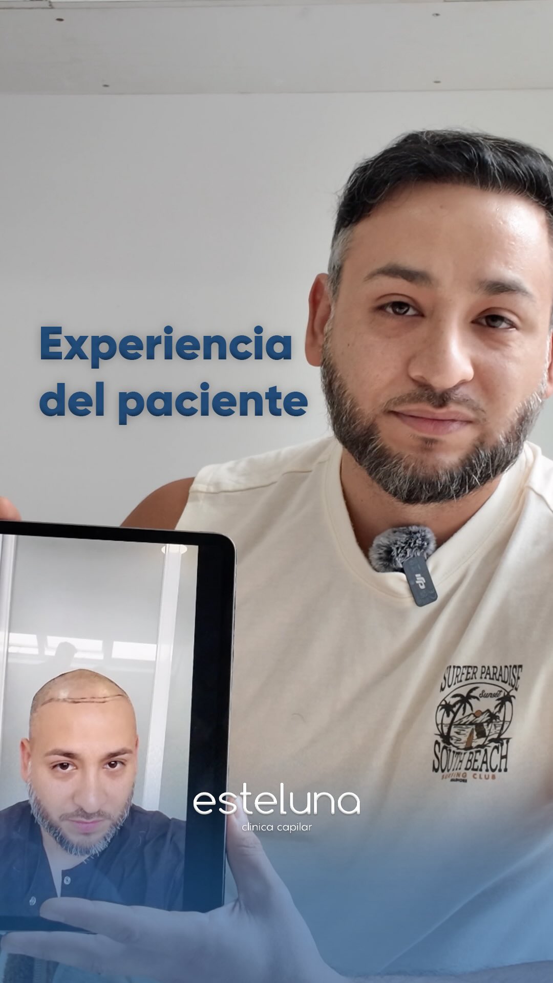 Esteluna Capilar Facebook ad: La experiencia de nuestro paciente después del trasplante…
