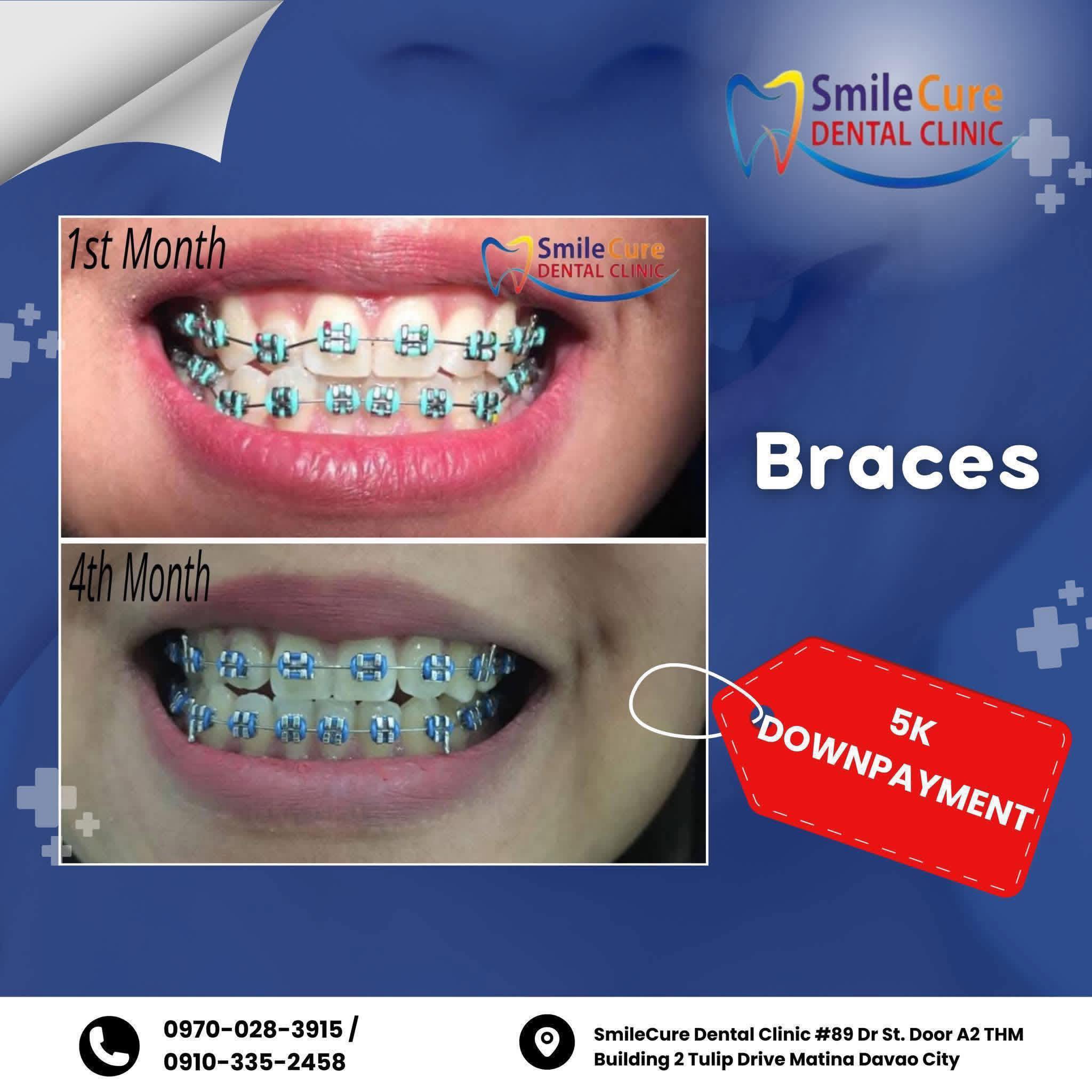 SmileCure Dental Clinic Tulip Drive Matina Davao Facebook ad