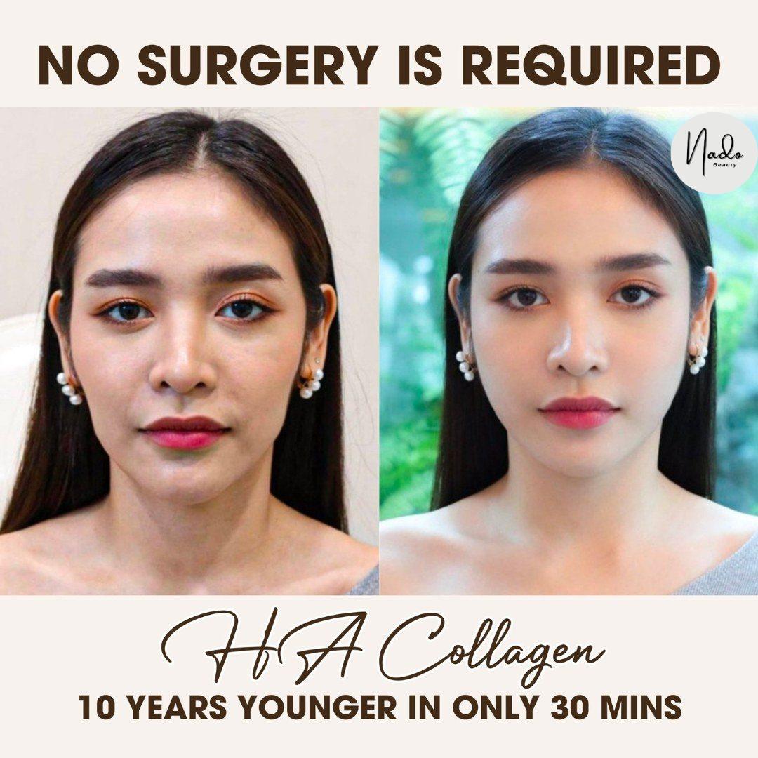 Nado Aesthetic Clinic Facebook ad