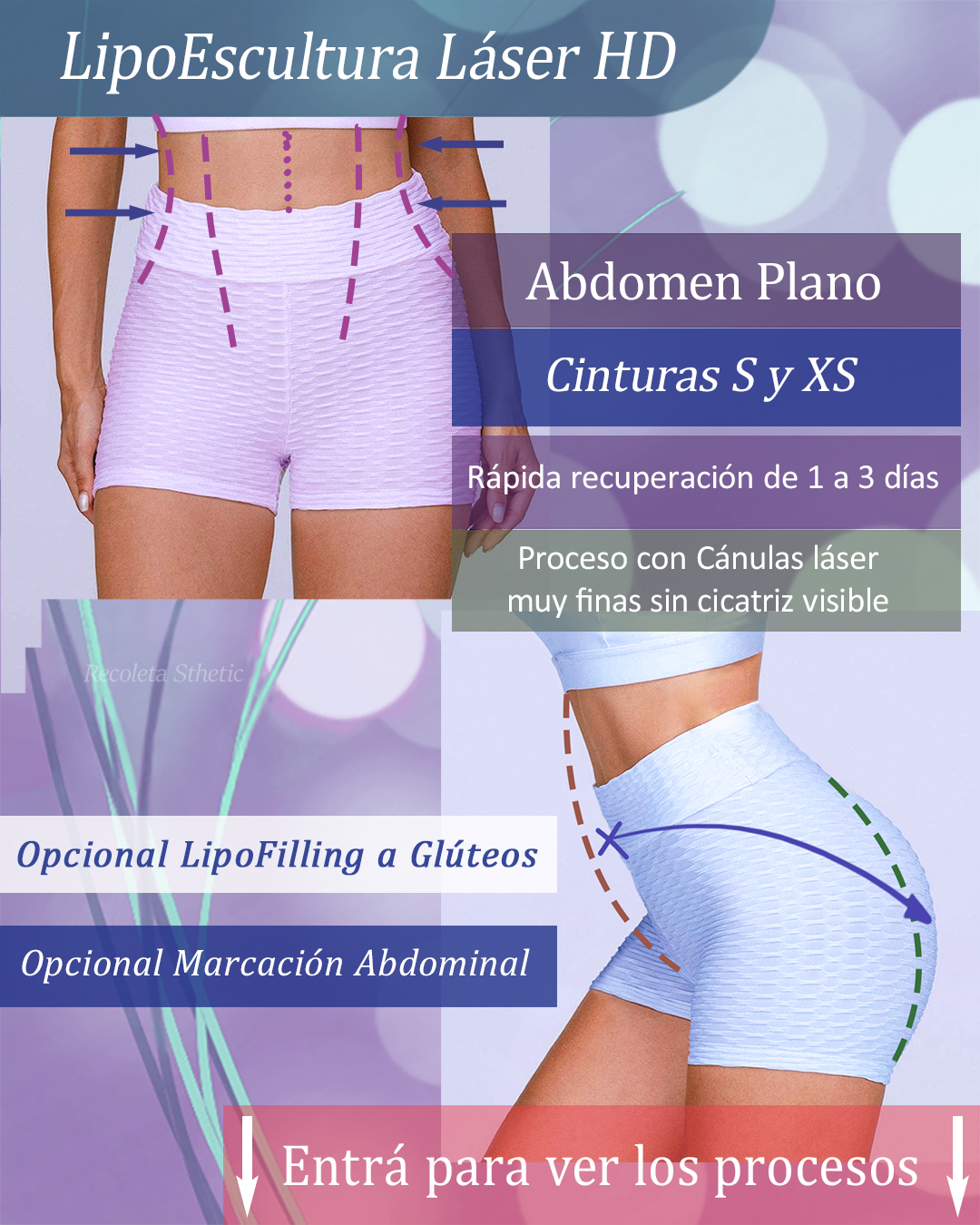 Recoleta Sthetic Facebook ad